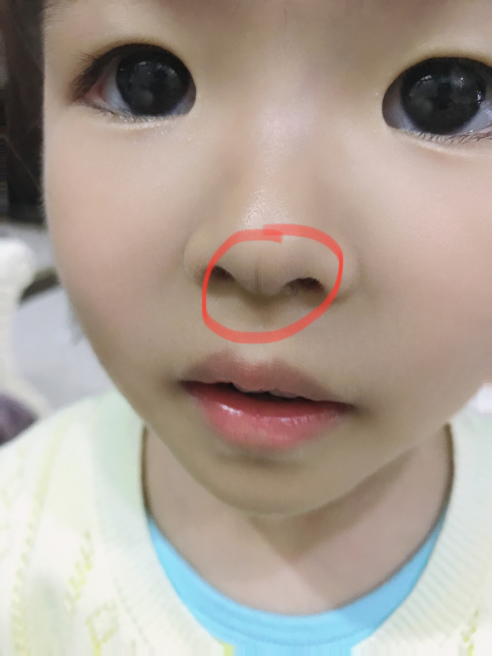 宝宝现在快三岁了,这条线还是有.