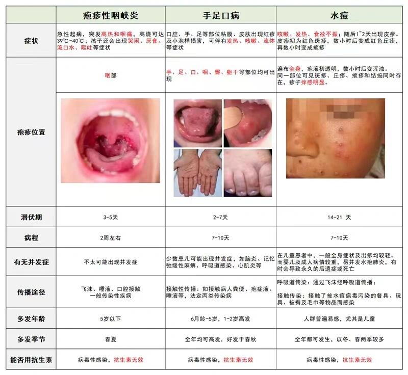 宝宝易患疾病 鹅口疮 手足口病 水痘 怎么辨别?如何治疗?