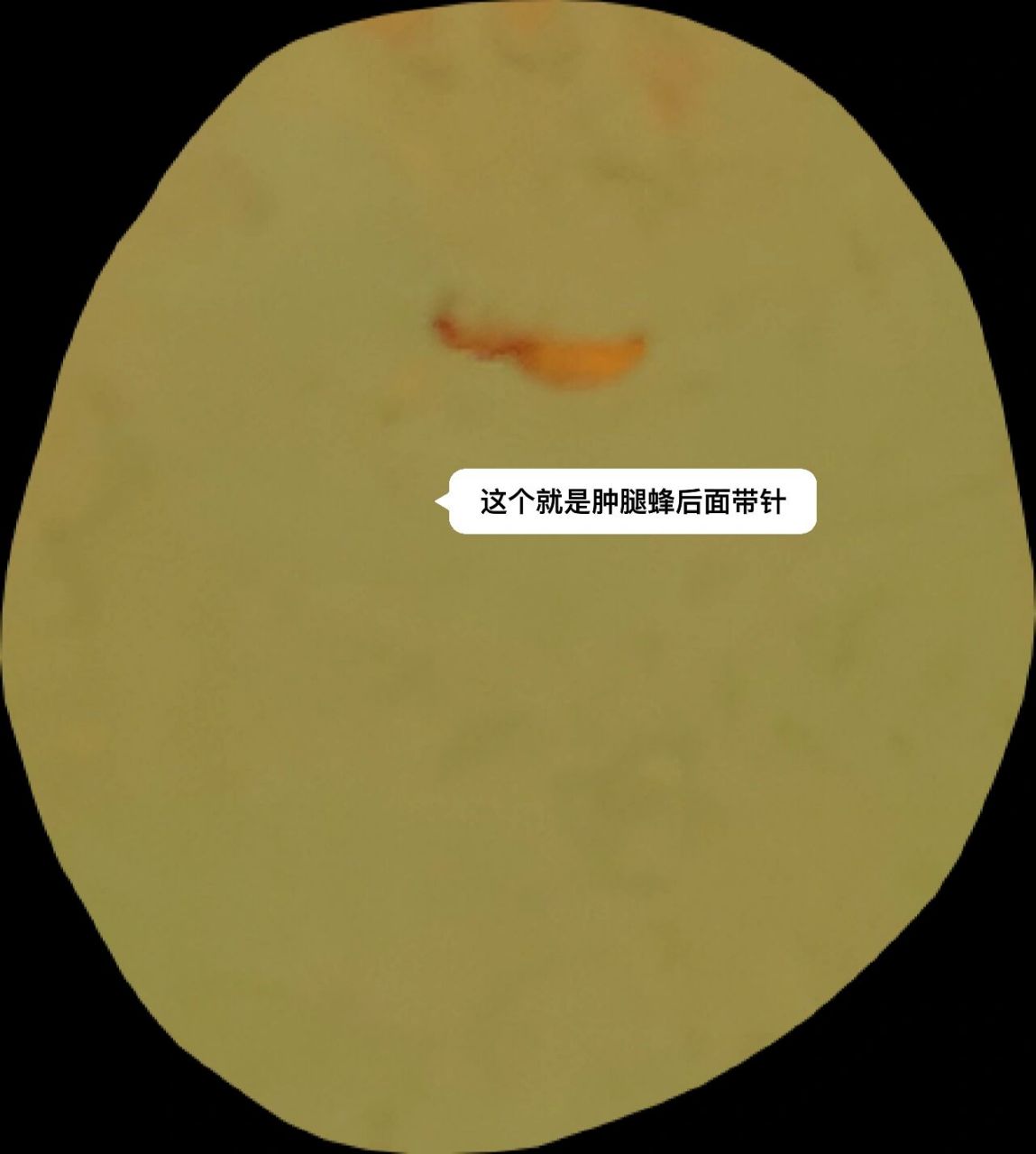 最近床上有像蚂蚁一样的虫子咬 蒽顾名思义这个虫子叫(肿腿蜂) 长那么