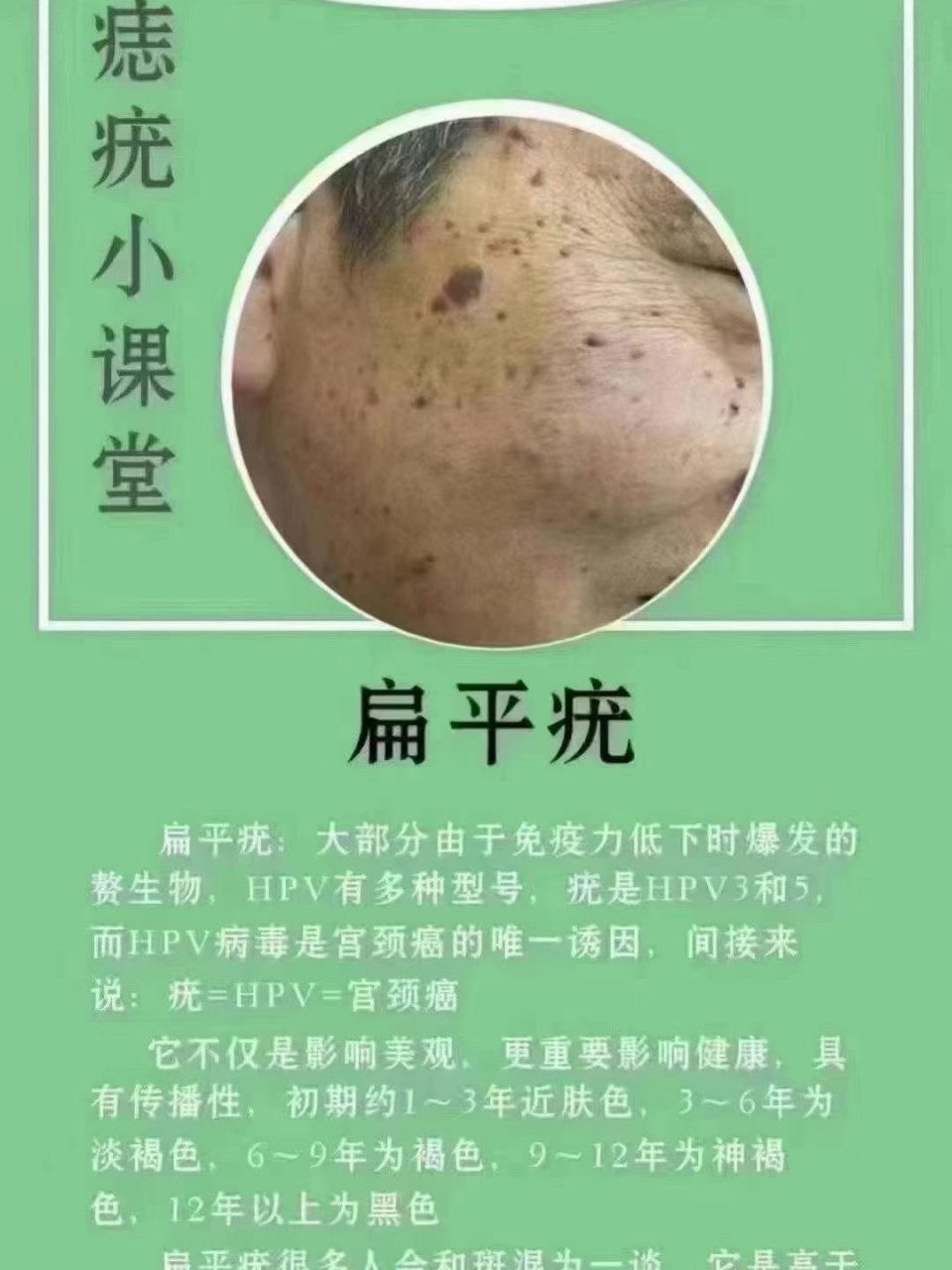 痣,疣小课堂,统统解决