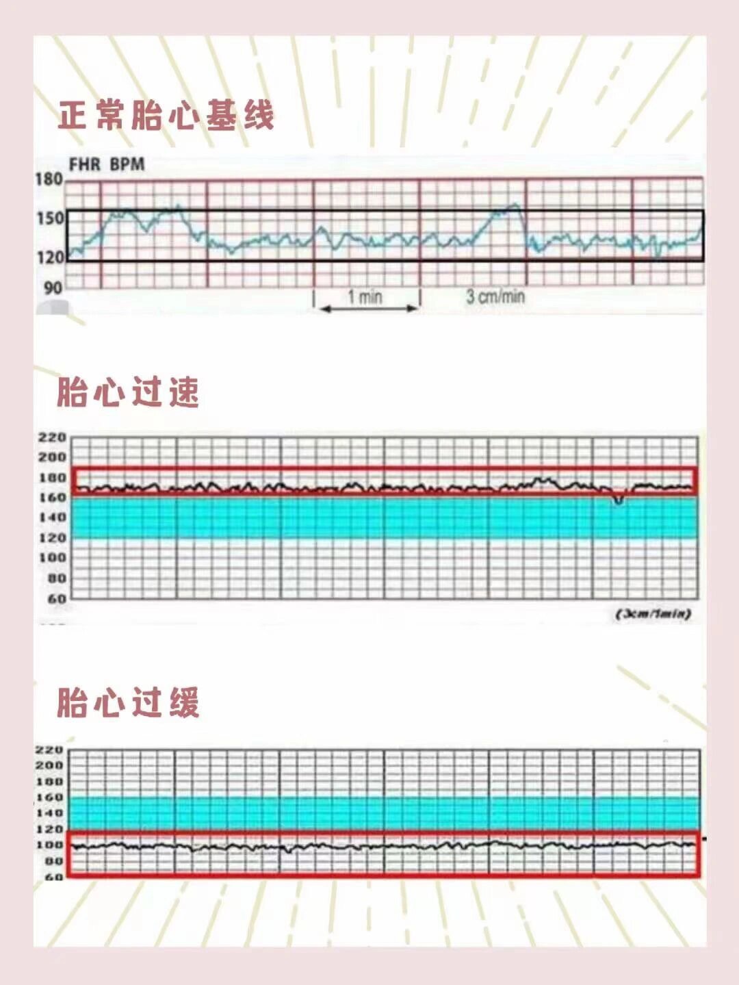 孕30周胎心位置图图片