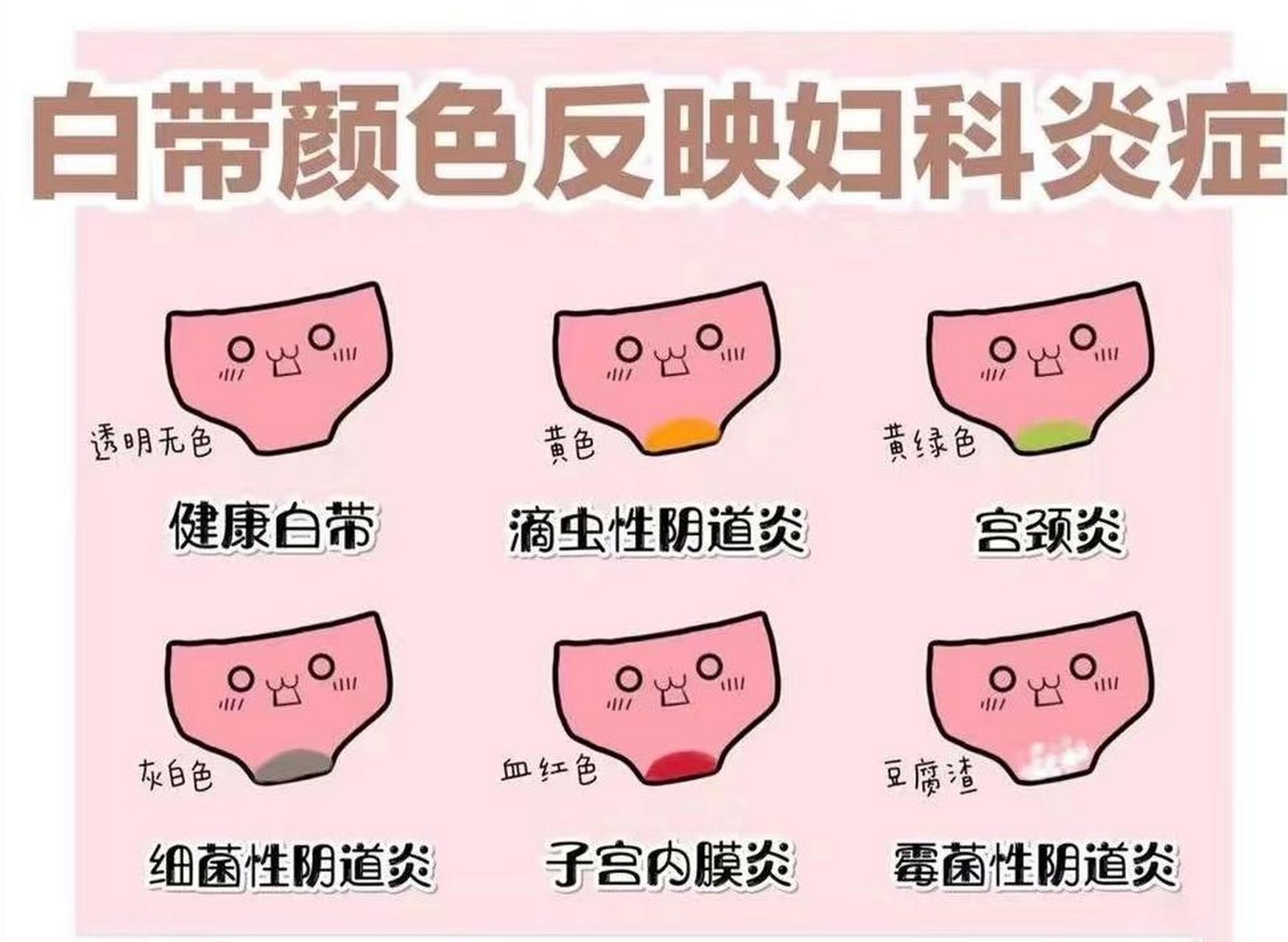 教你看图1分钟分辨不同妇科疾病的症状 女性朋友们学习一下 爱自己,先