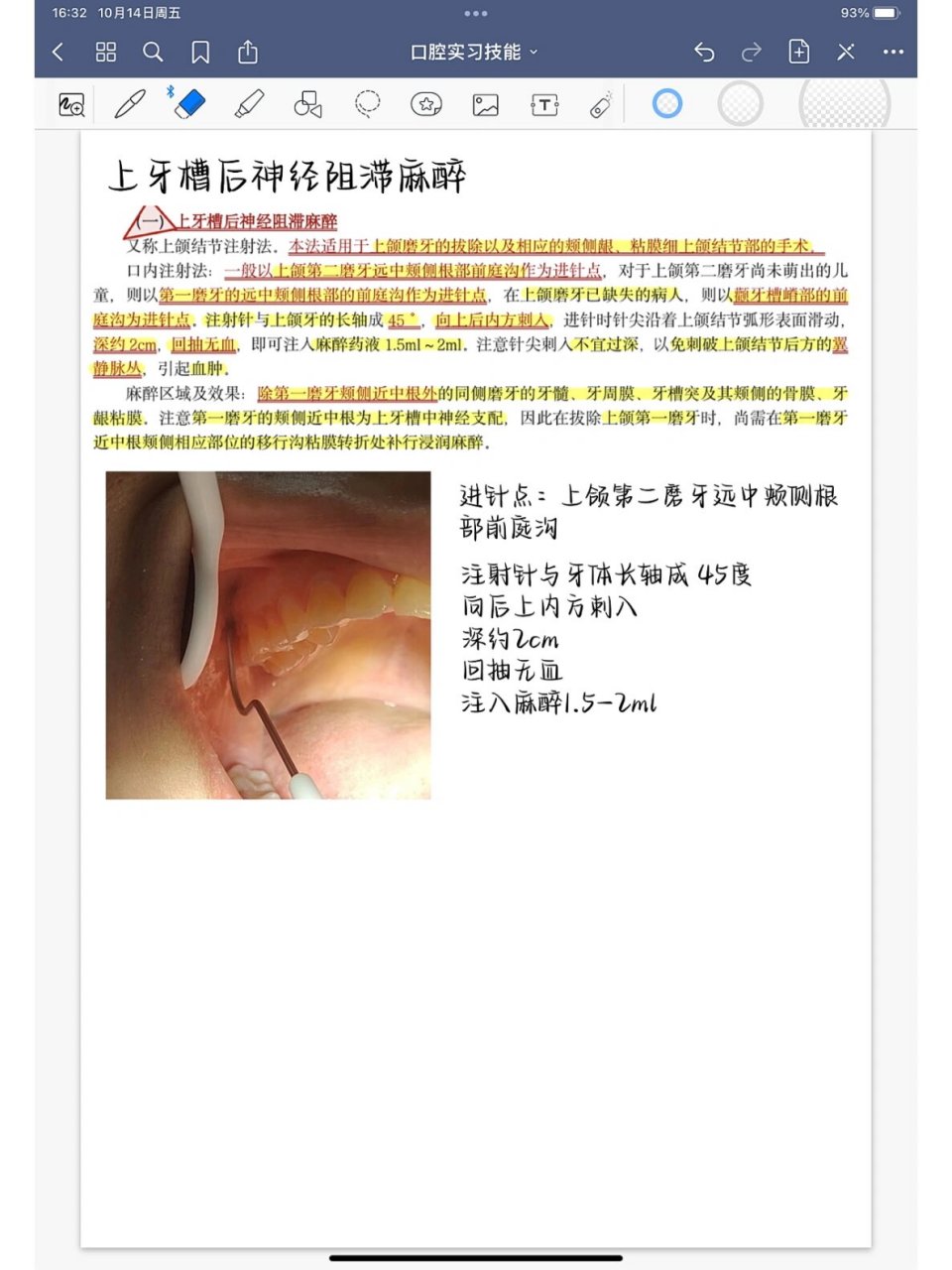 麻药多久失效图片