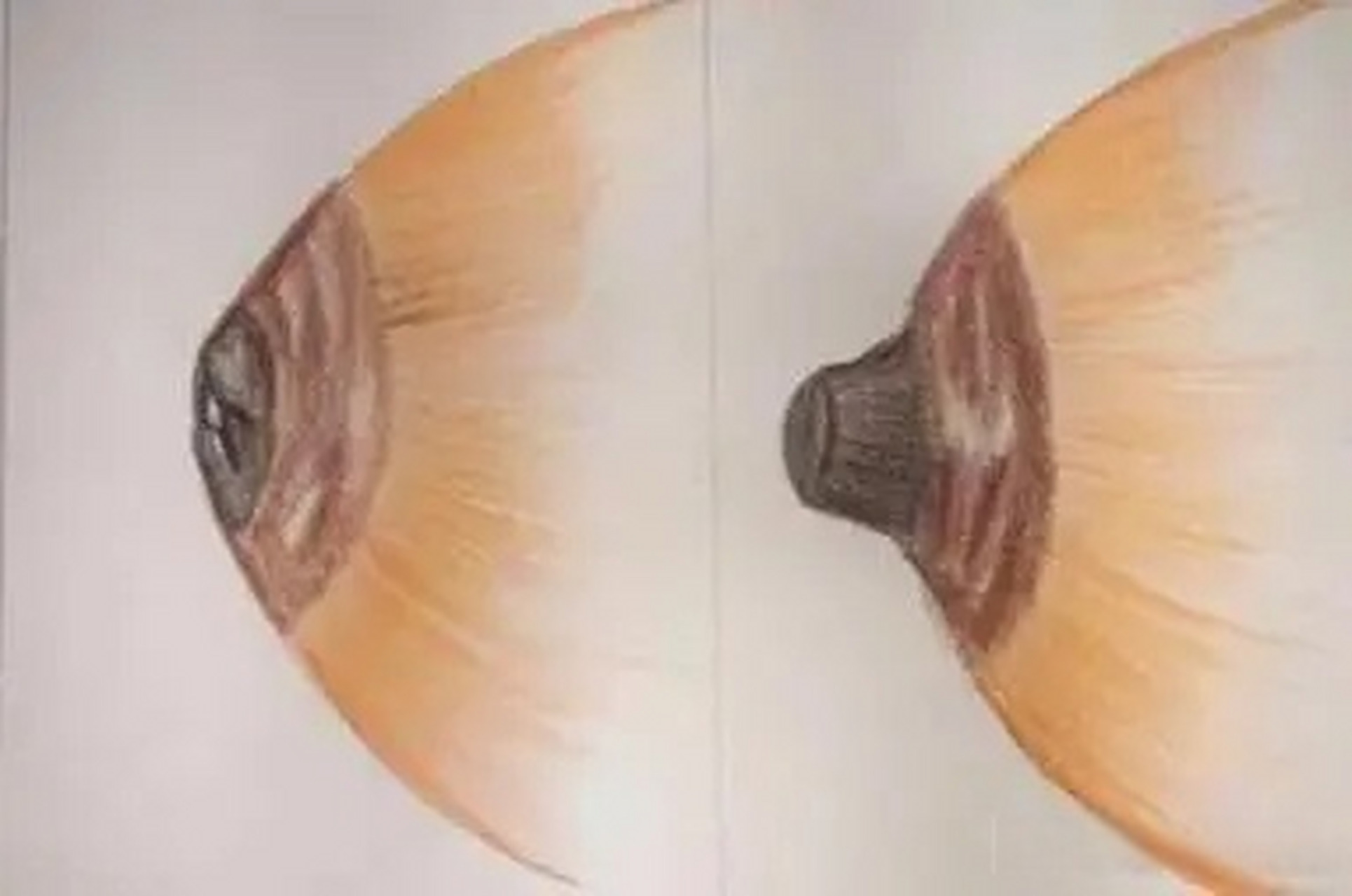 没想到这5类竟是#浆细胞性乳腺炎# 发病诱因!