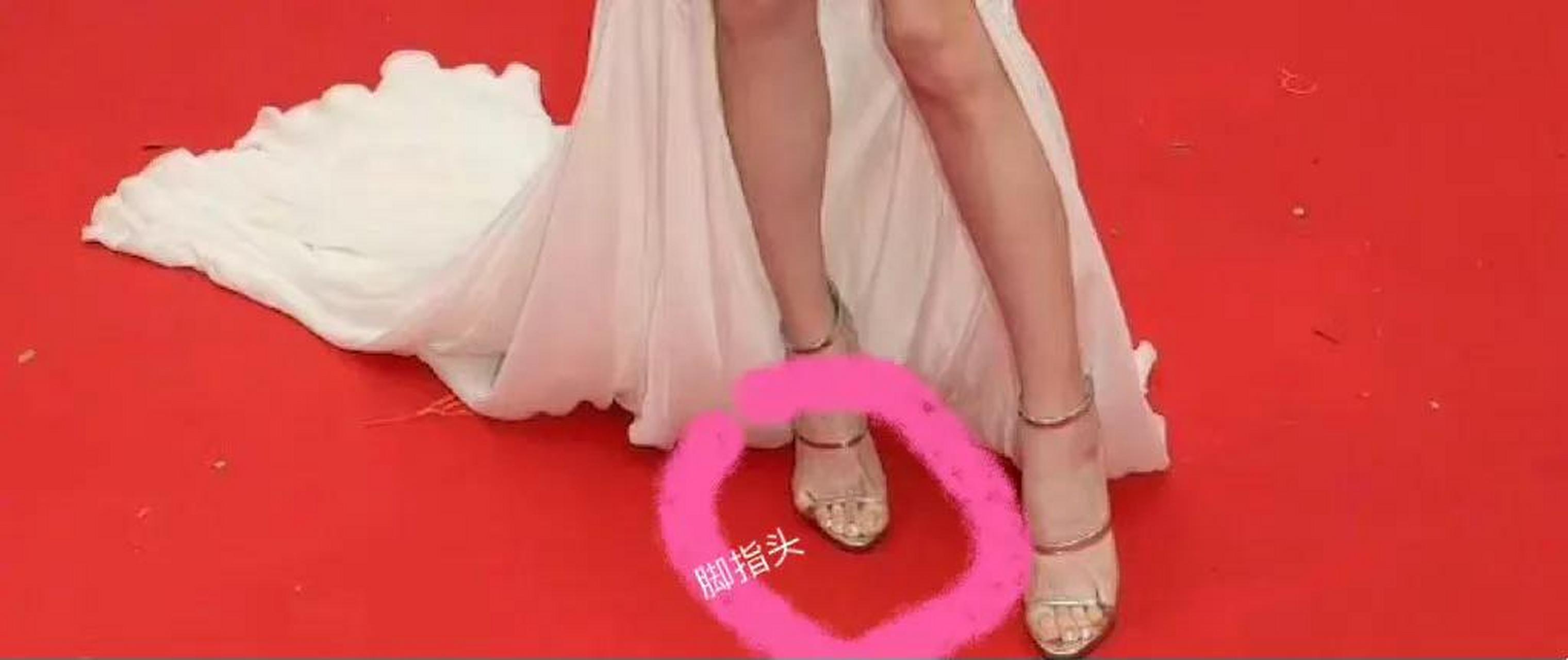 张雨绮的脚背宽胖,根本就不适合穿这种一字杠凉鞋,所以她的两个小脚趾