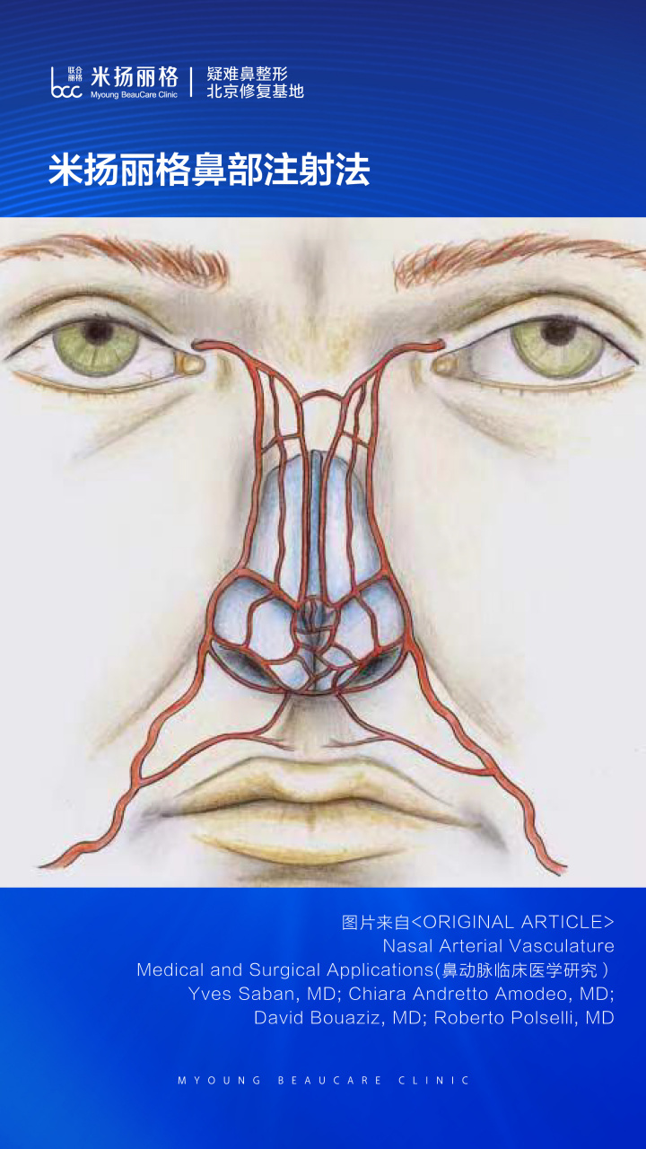 鼻部血管错综复杂,从安全性角度分析,注射隆鼻找鼻整形医生更为安全!