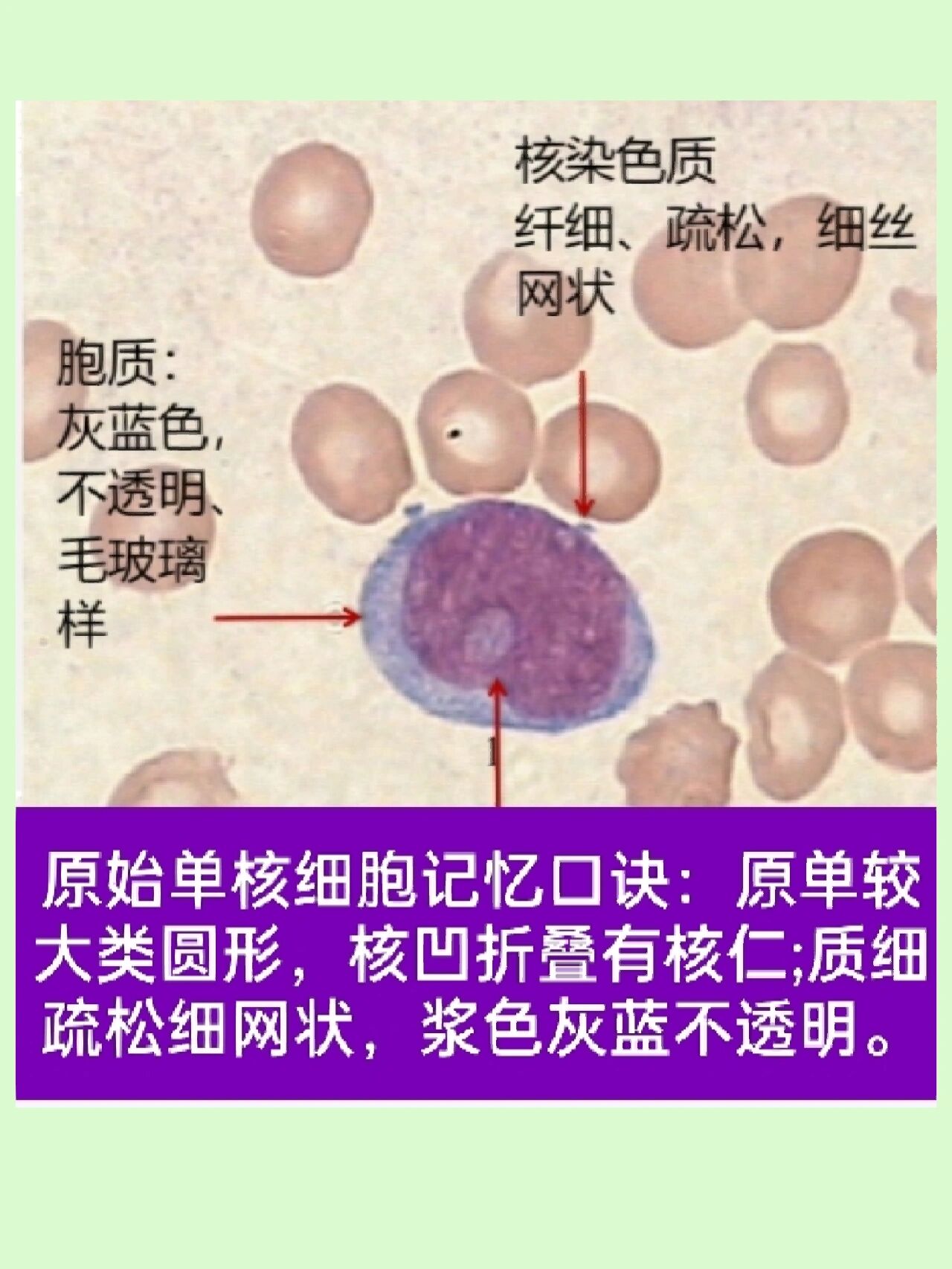 原始单核细胞幼稚图片