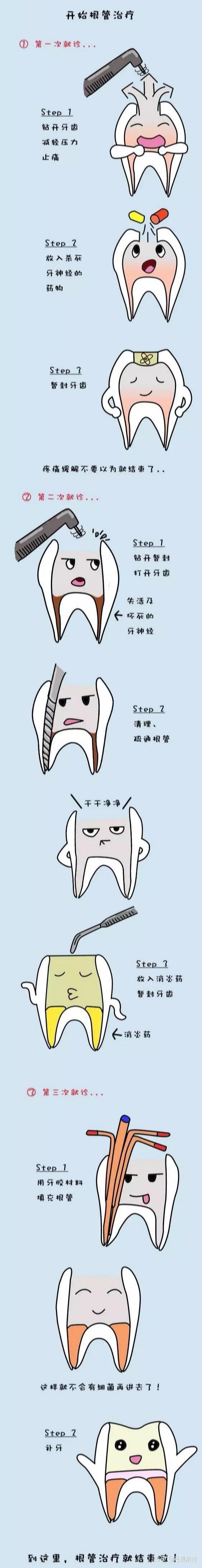 口腔做根管治疗的步骤方法具体点