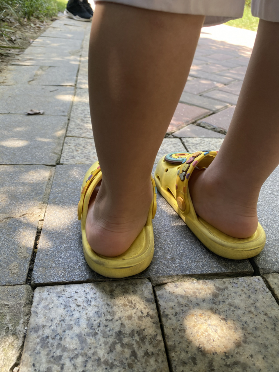 三岁宝宝足外翻扁平足怎么办宝妈们 宝宝刚三岁,以前没有注意这个问题