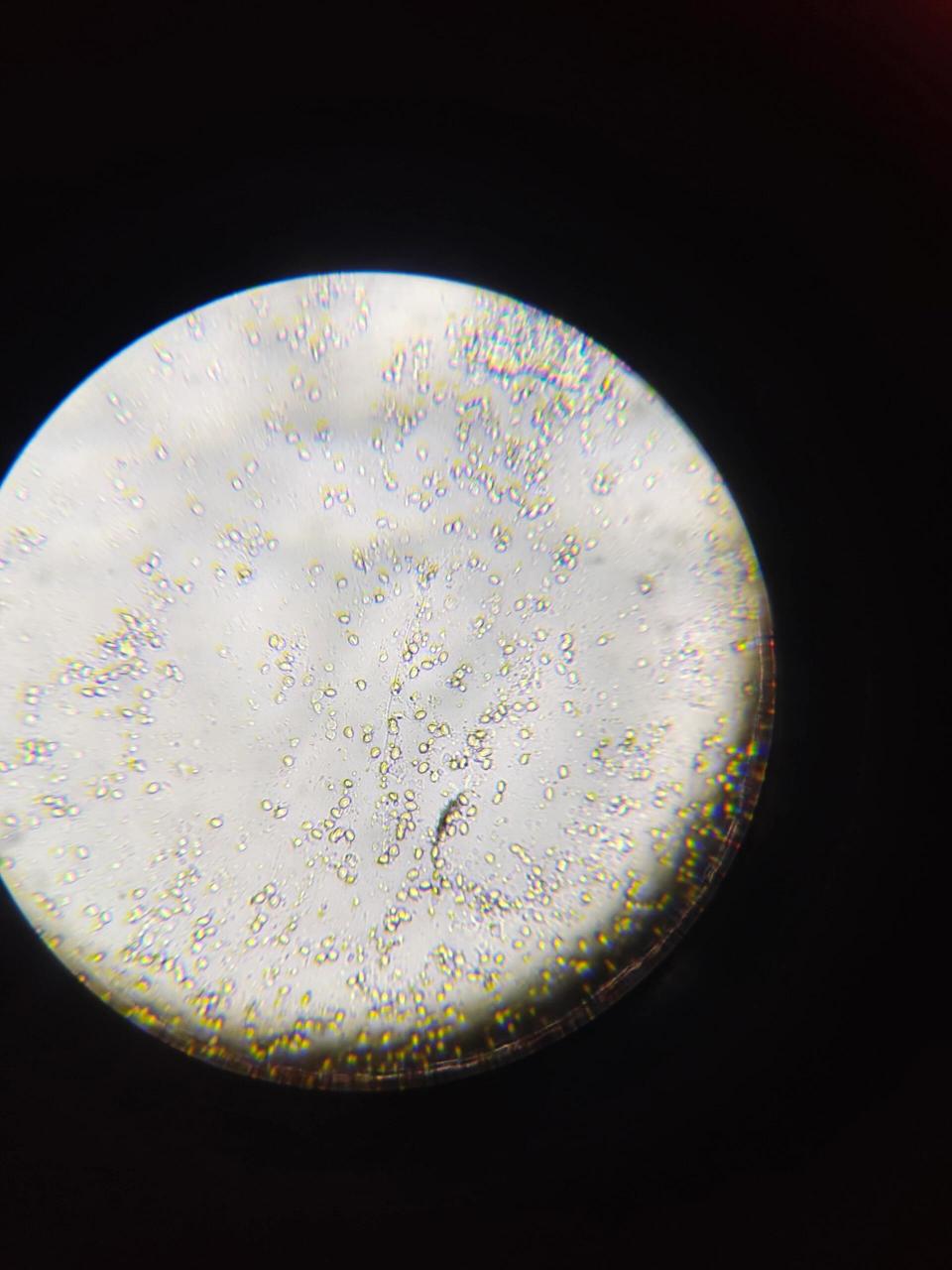 显微镜下的鱼鳃 第一次尝试用显微镜, 发现了指环虫, 图一是80倍下的