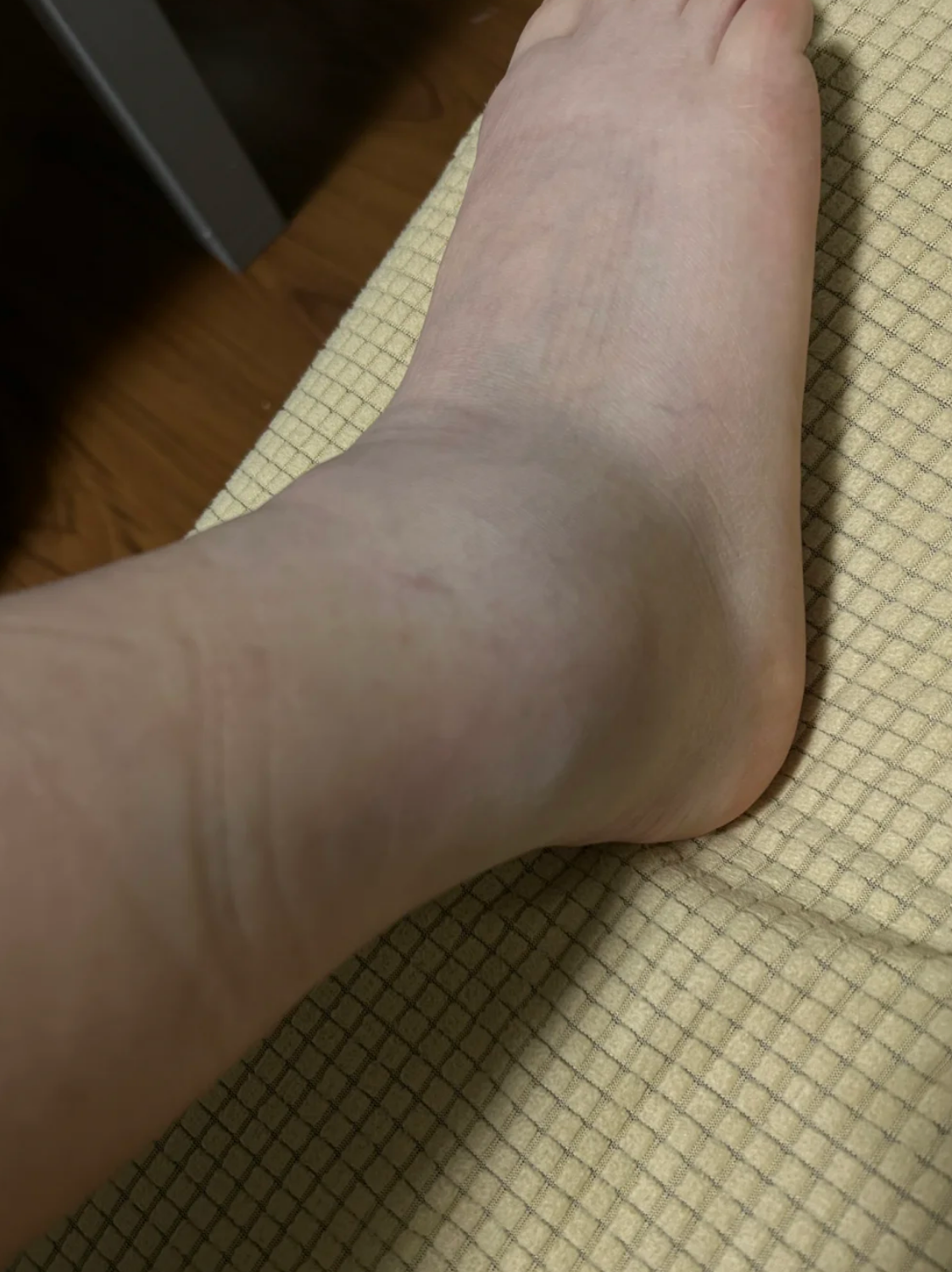 为什么没有脚脖子 为什么没有脚脖子