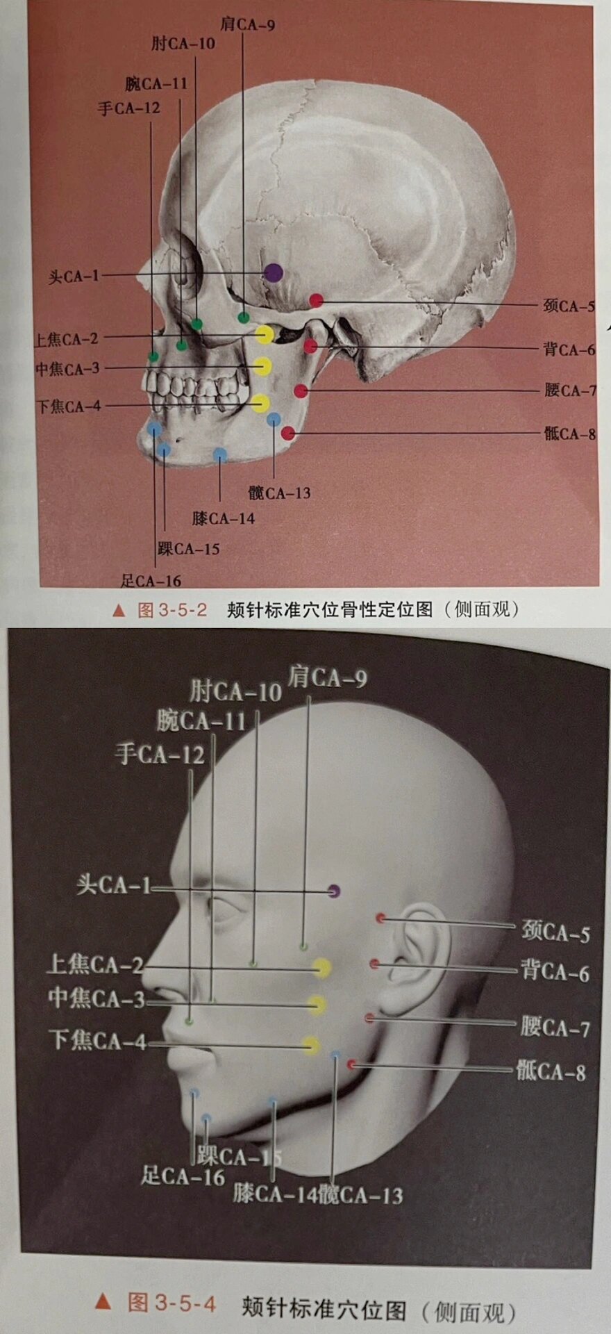 颊针 基础穴位定位