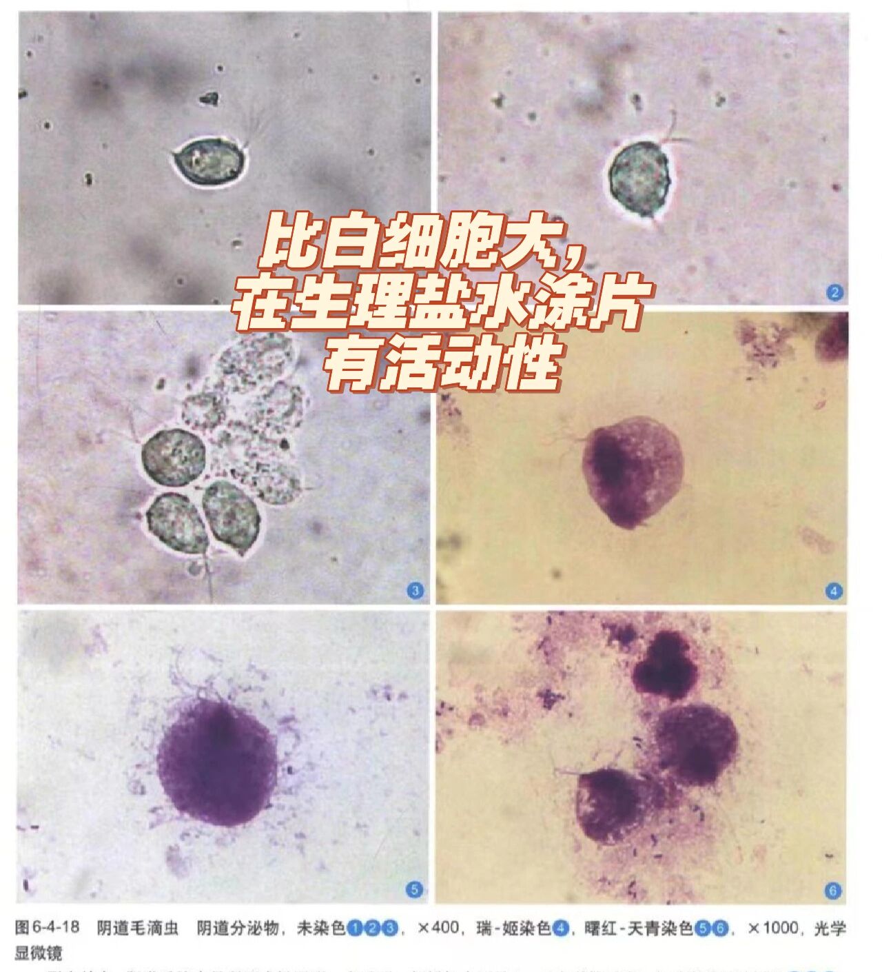 白带常规镜检图片教学图片