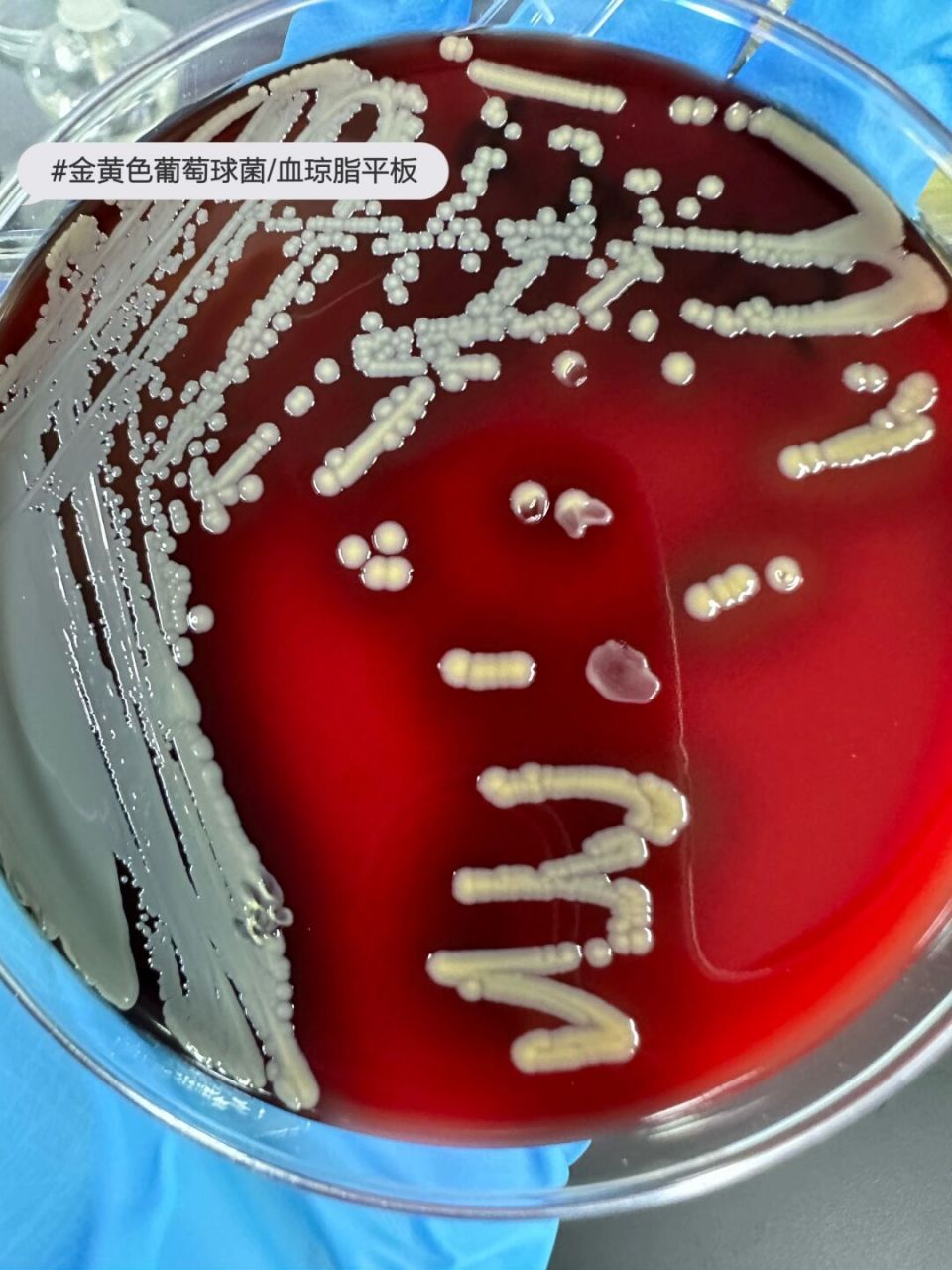 金黄色葡萄球菌 #医学检验# #微生物#