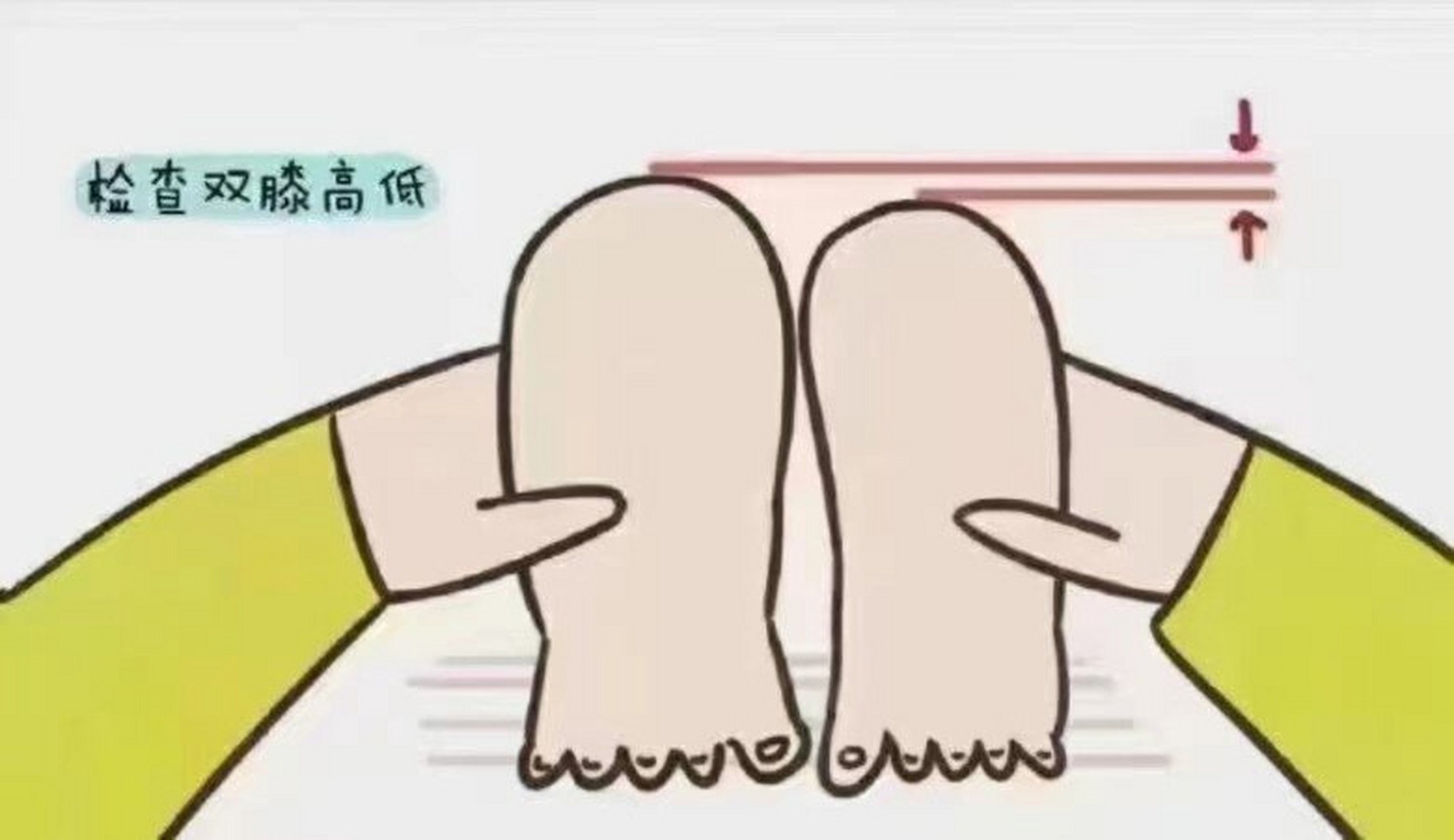 髋关节在家自测 宝宝太胖,腿纹不对称,妈妈就会觉得宝宝是不是髋关节