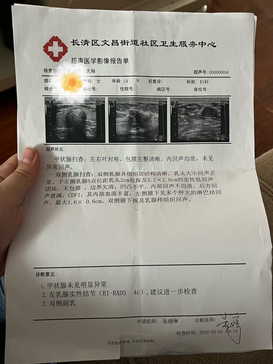 乳腺结节4c图片