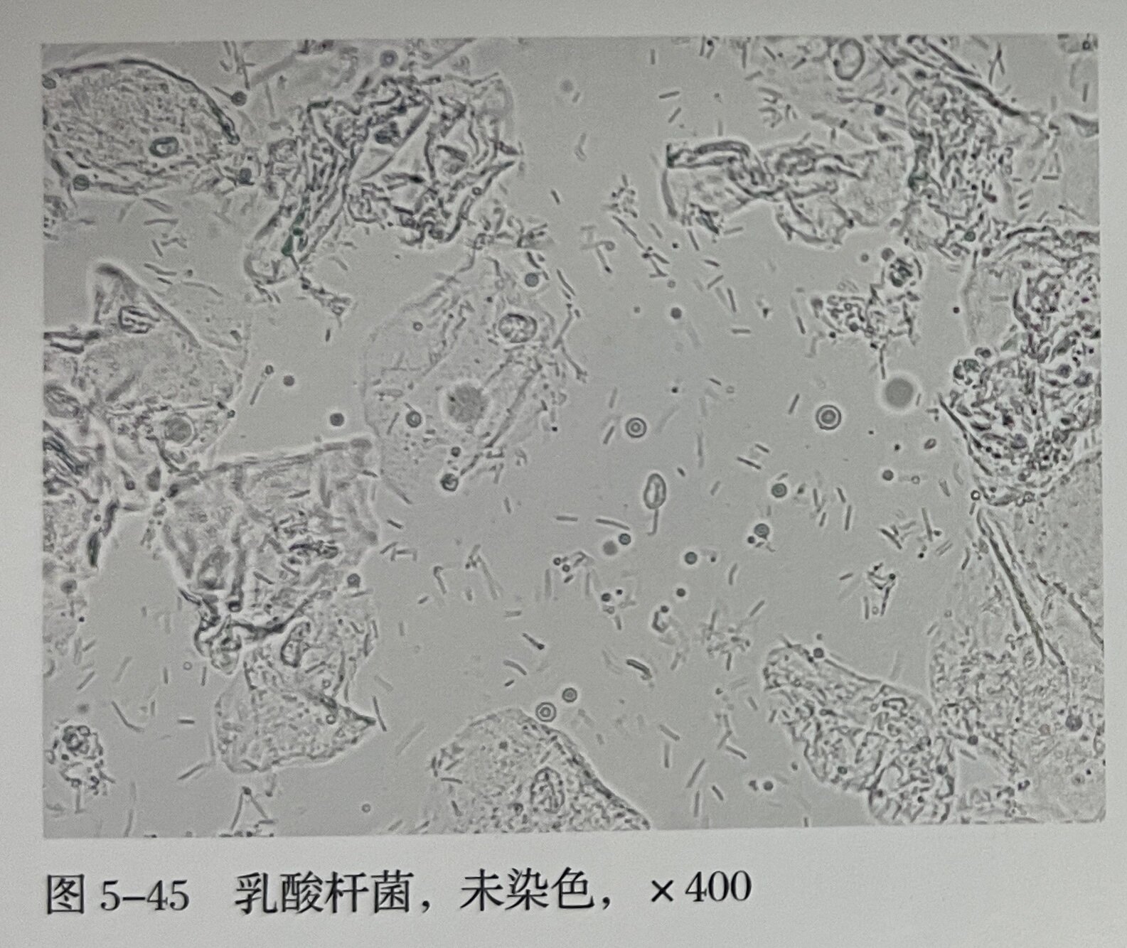 白带镜下乳酸杆菌形态