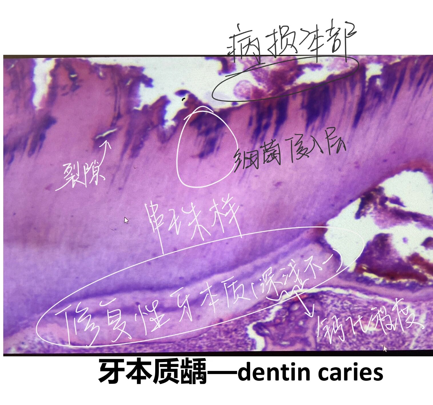 牙本质绘图图片