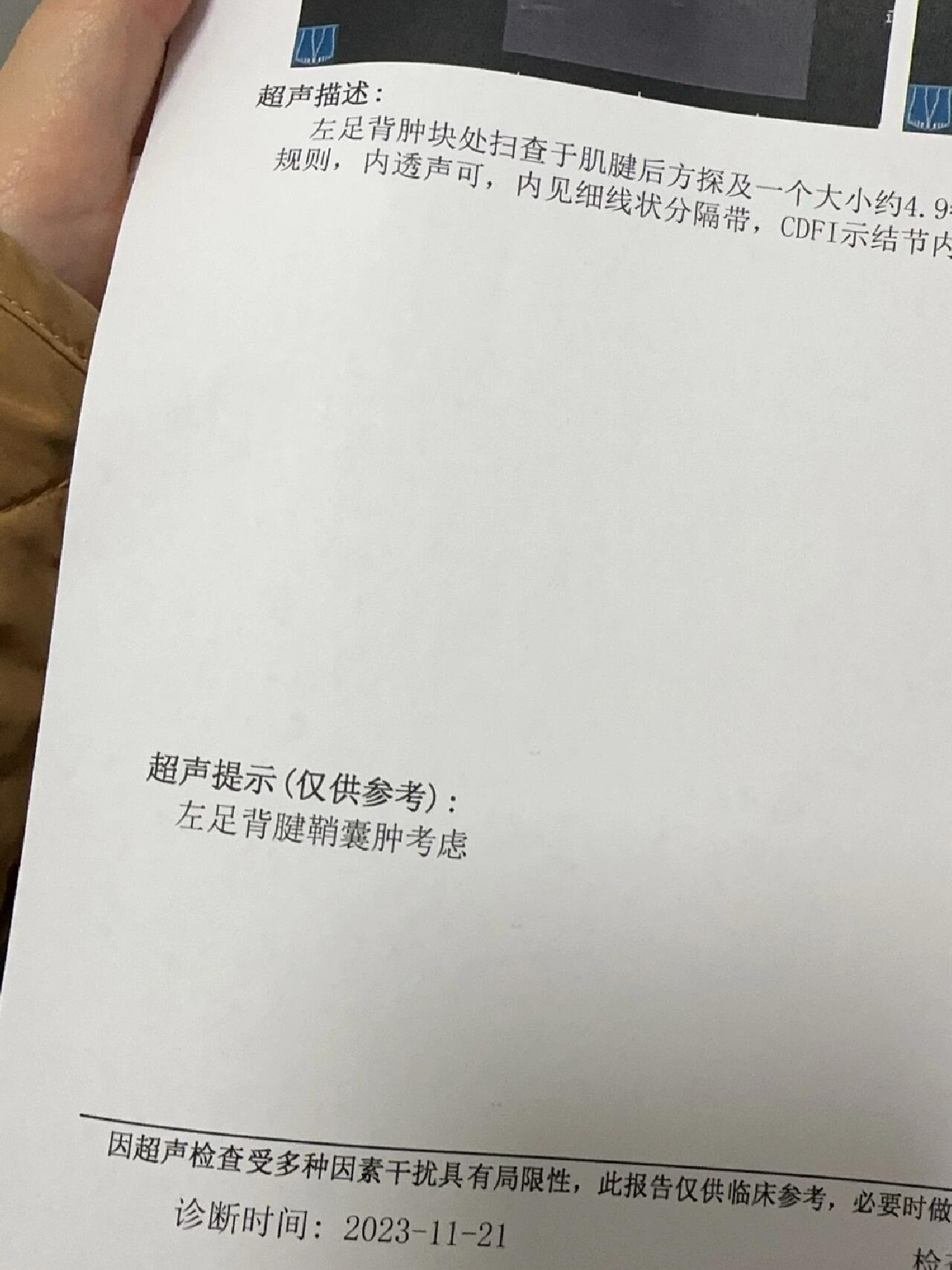 腱鞘囊肿了 某天早上起来走路突然左脚脚背疼 摸摸有一颗小小的硬硬的