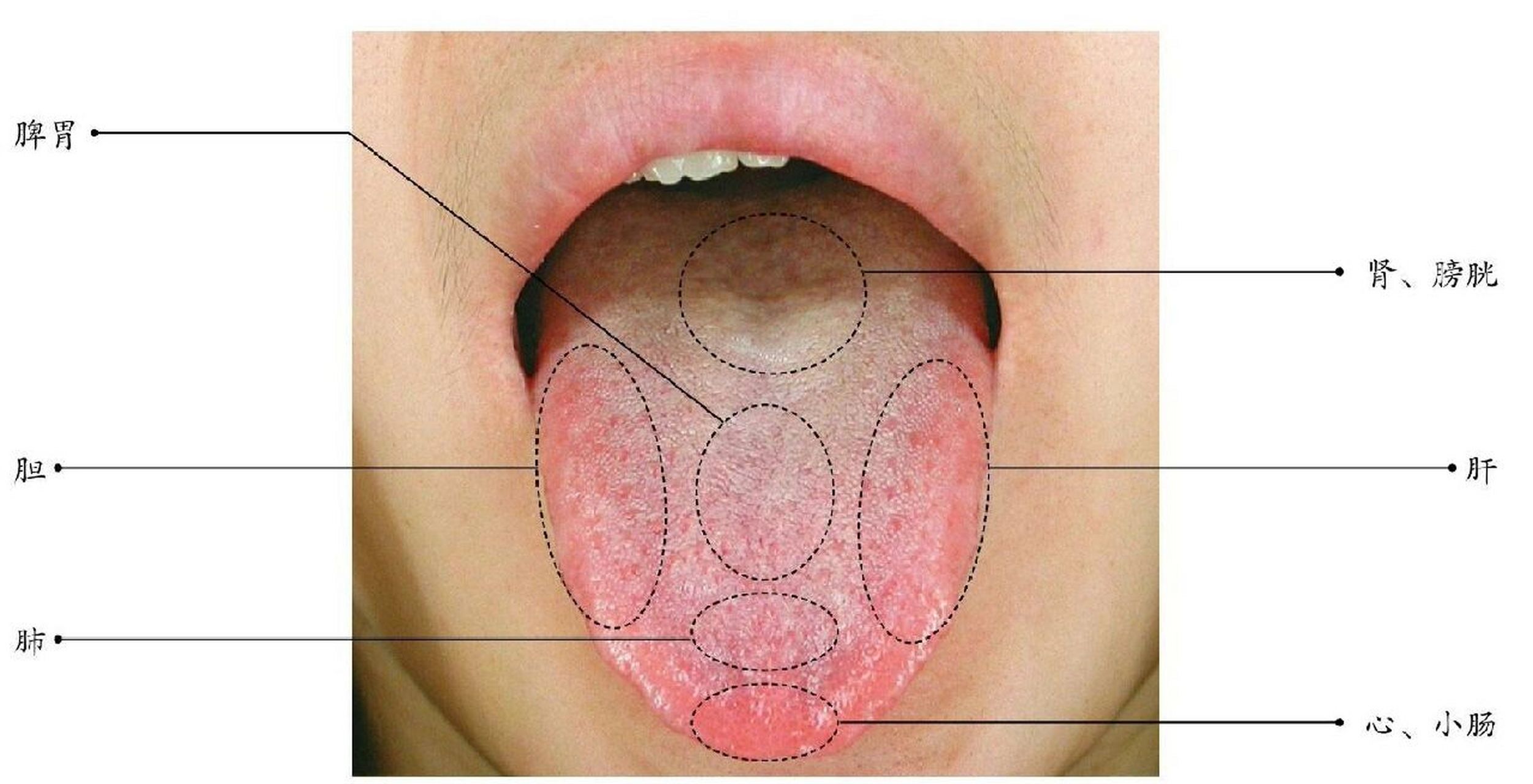 舌头正确位置图片