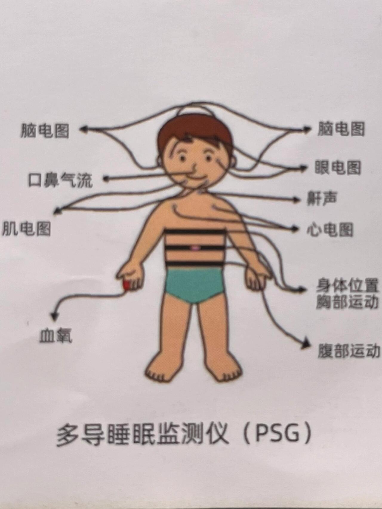 96精神科 多导睡眠监测仪(不详版) 睡眠障碍患者 障碍等 可完善多导