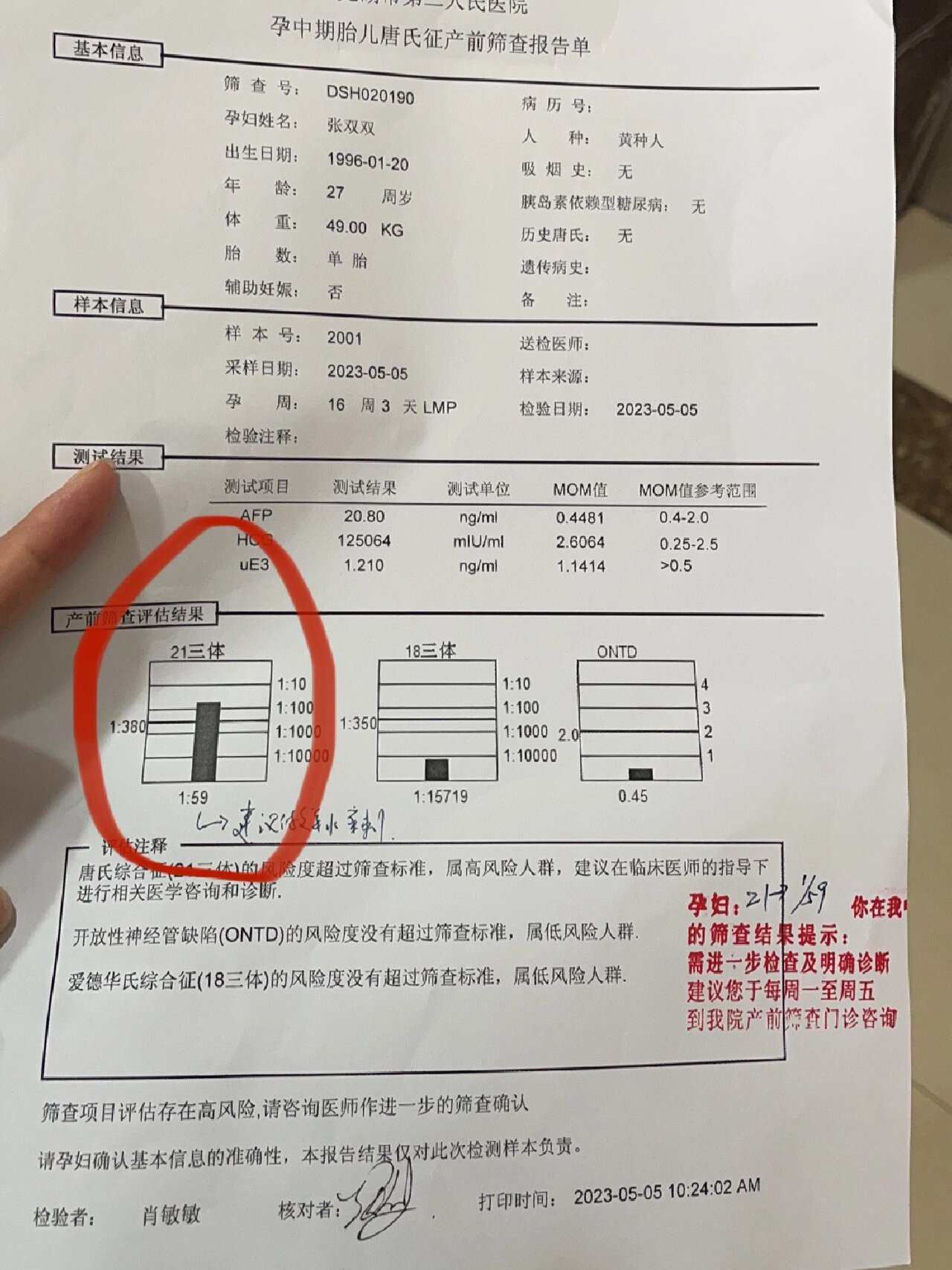 唐氏筛查21三体高风险 怀个孕感觉人都快疯了,4号做的糖筛昨天医院打