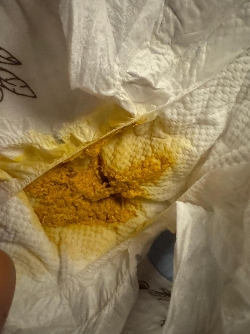 纯母乳喂养 月子里的宝宝拉奶瓣 放屁崩屎 图一图二是没喝益生菌拉的