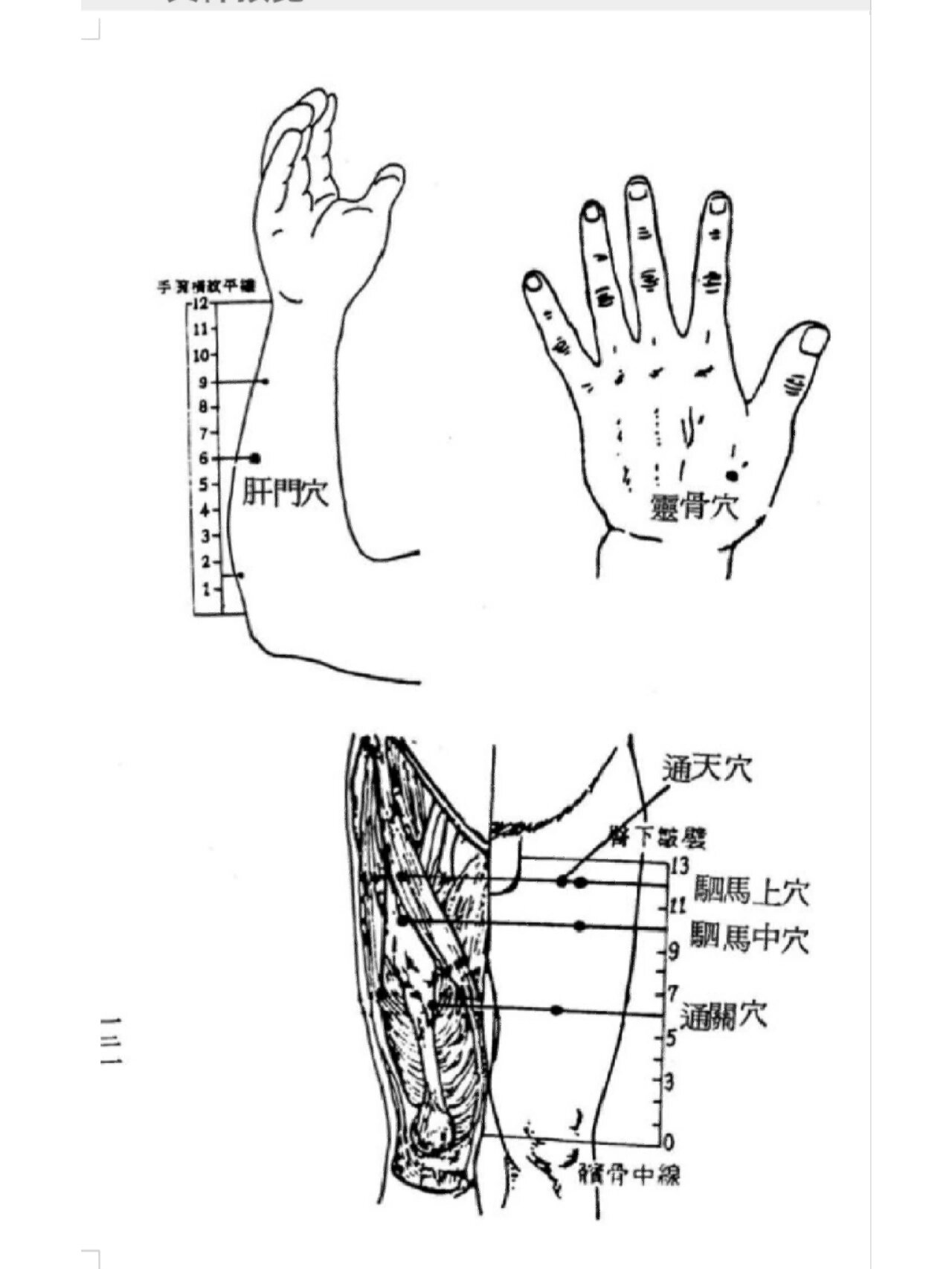 肺气肿 针灸 【肺气肿】 呼吸困难,脸色变成土色,发生浮肿,食欲减低