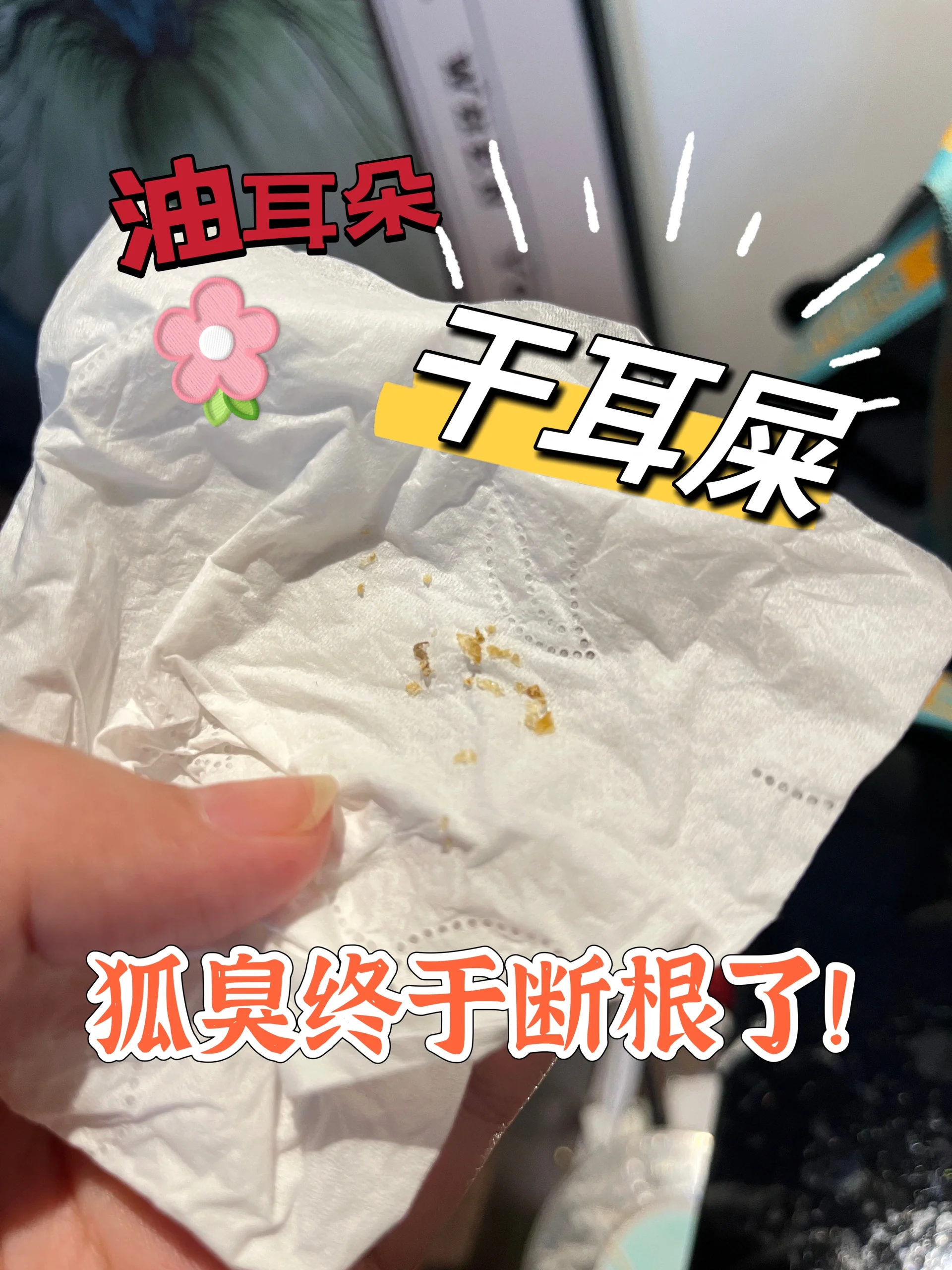 为什么油耳朵就有狐臭