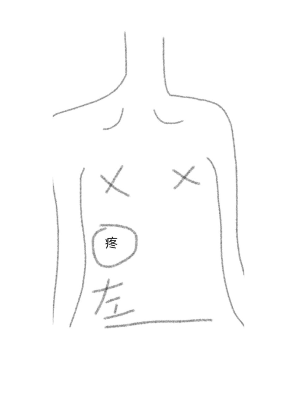 左侧肋骨 隐痛图片