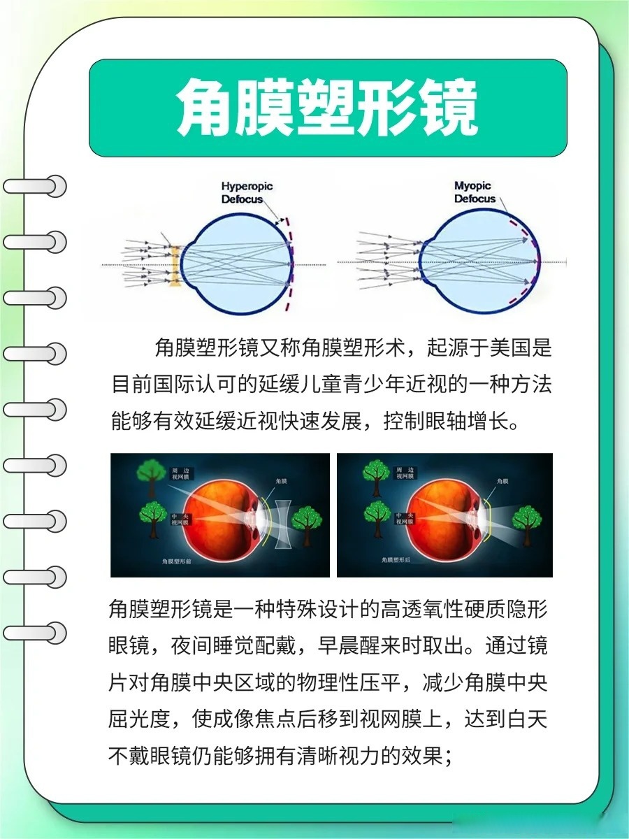 ok镜的原理图片