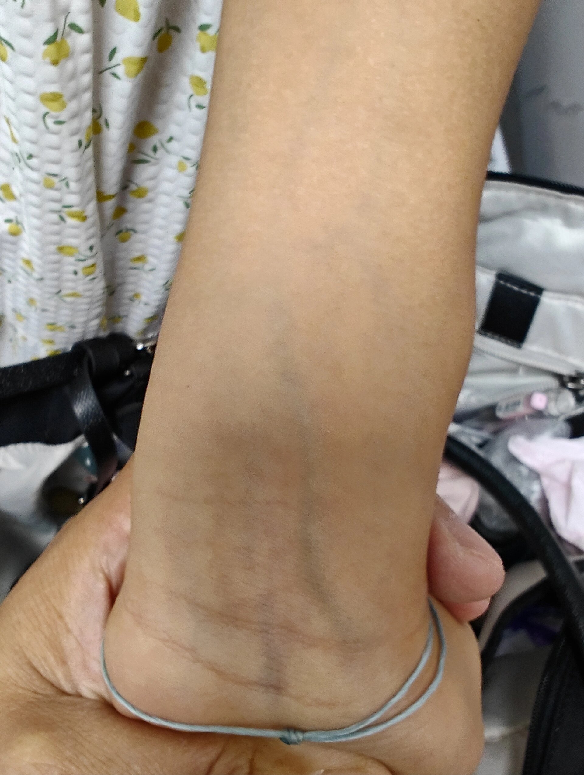 紫血管和绿血管 什么橄榄色橄榄皮太复杂了,像我们当地压根不生产种植