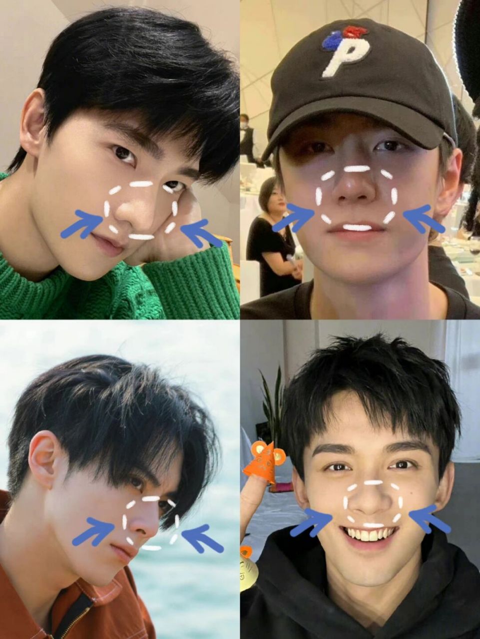 男明星是怎么去黑头的啊?