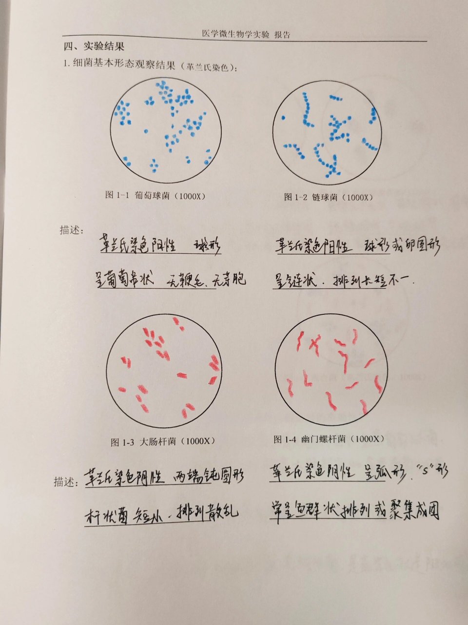 大肠杆菌手绘图红蓝图片