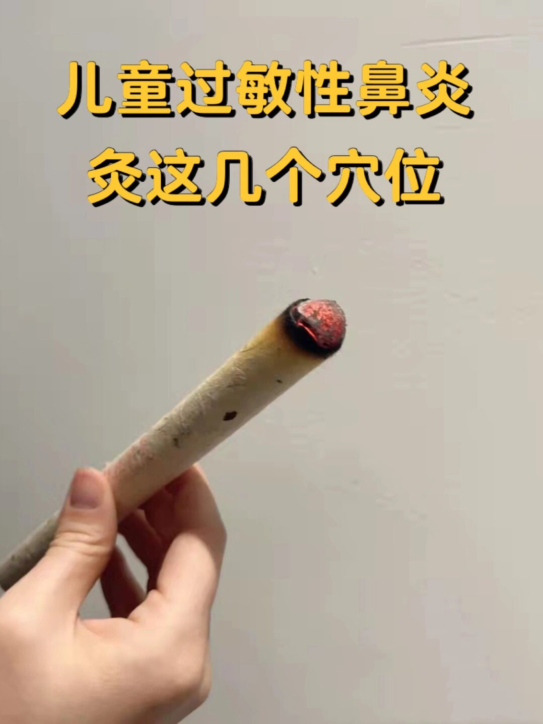 有妈妈问我说孩子过敏性鼻炎怎么艾灸,今天来跟大家分享一下过敏性
