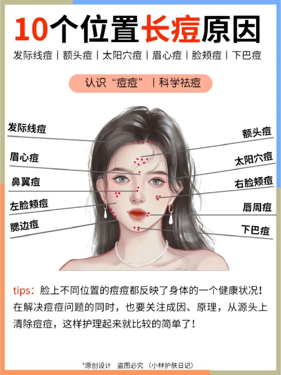 不过不同位置长痘