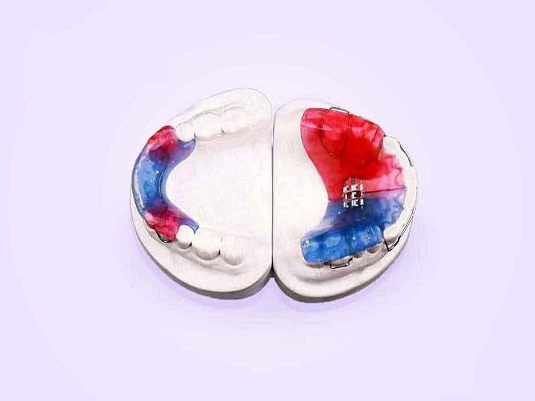 9494twinblock矫治器使用说明 twinblock矫治器(双阻板矫治器)