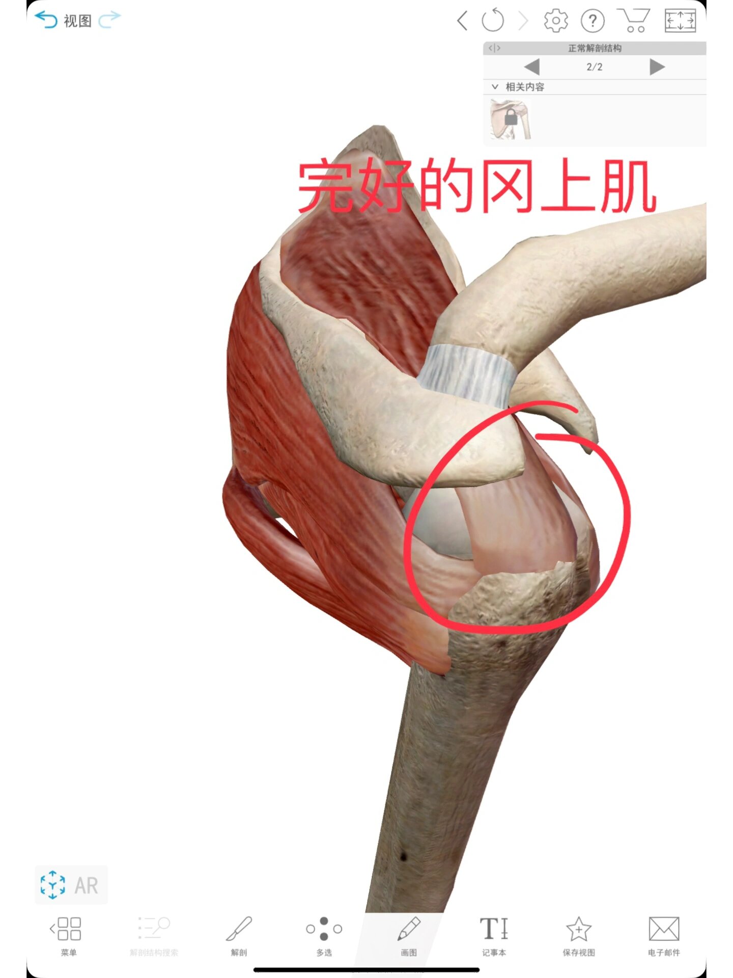 冈上肌撕裂该如何康复呢?快收藏起来吧