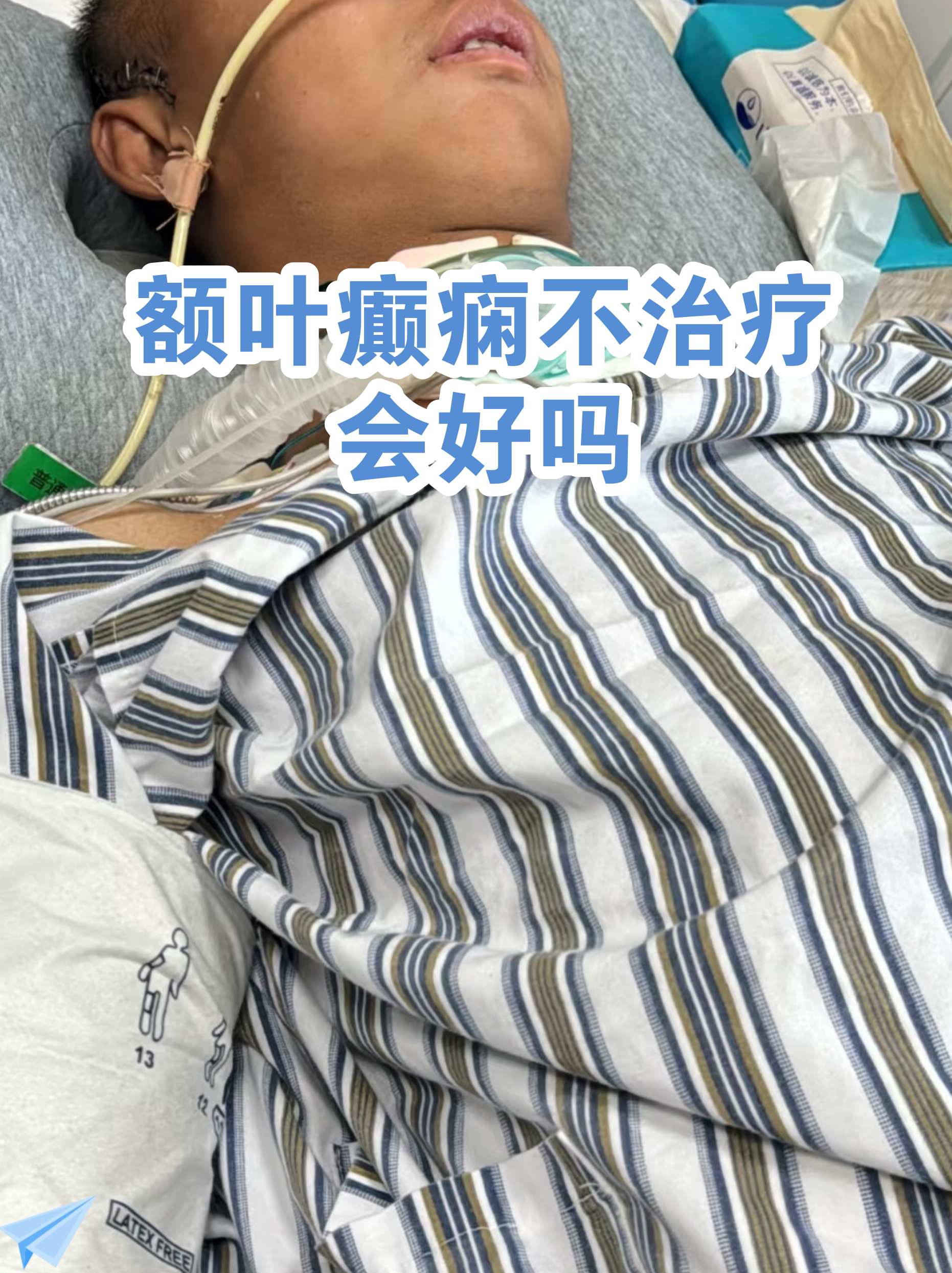 北京胸科醫(yī)院預(yù)約掛號陪診一體復(fù)雜病情綜合分析，治療方向更明確的簡單介紹