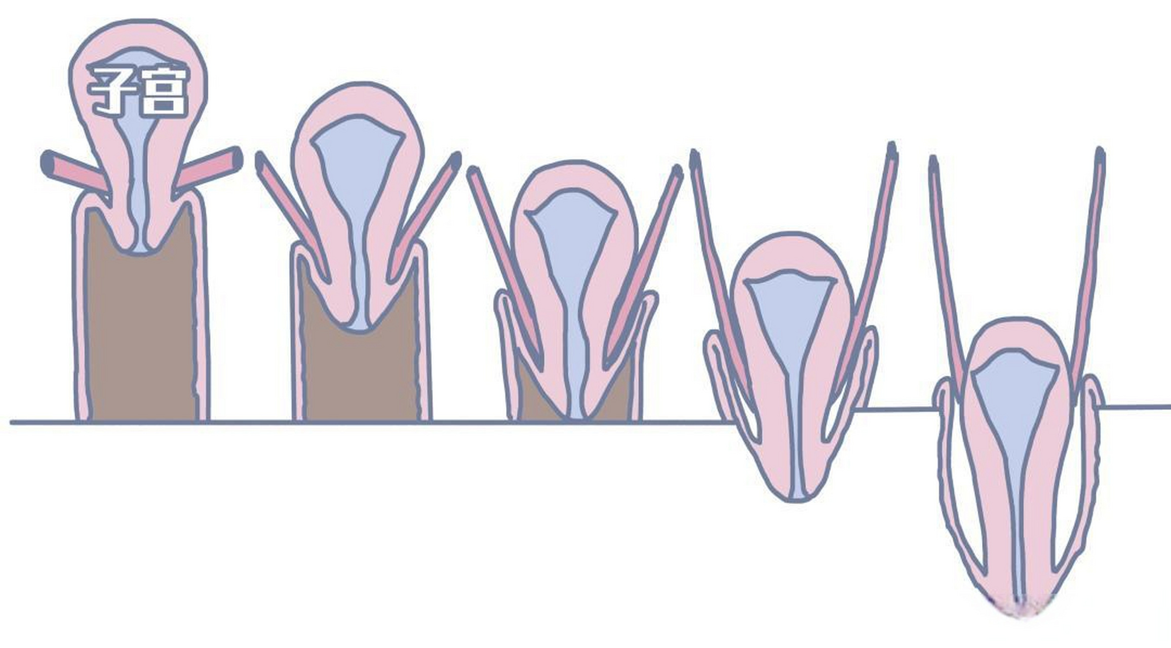 子宫脱垂复位后,为什么会反弹 ,真相是什么 现在子宫
