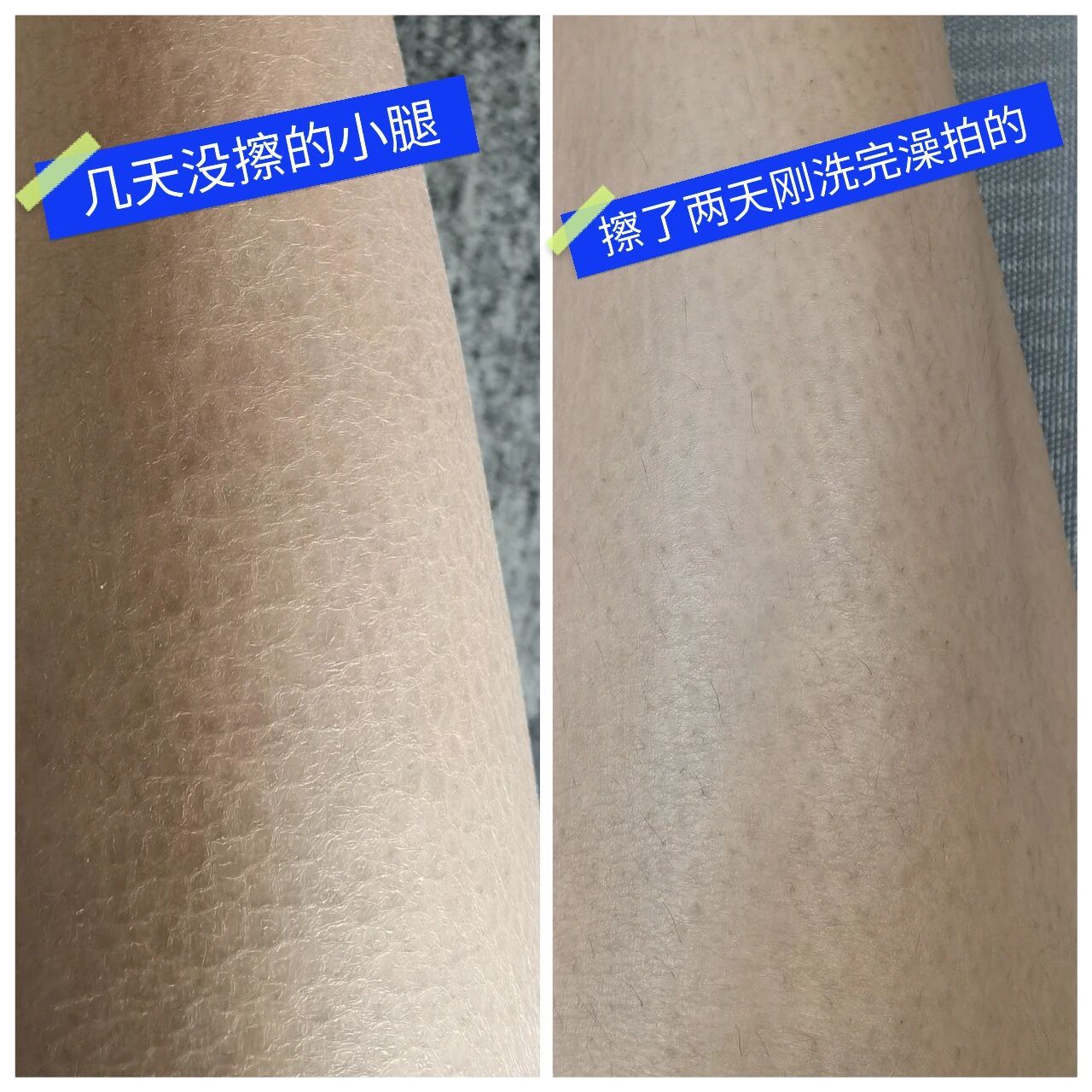 干皮症蛇皮纹怎么解决? 秋冬沙漠大干皮姐妹的救星,亲测好用!