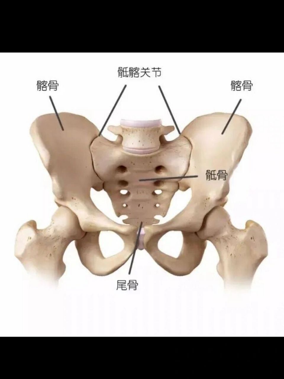 双侧骶髂关节炎能根治吗?