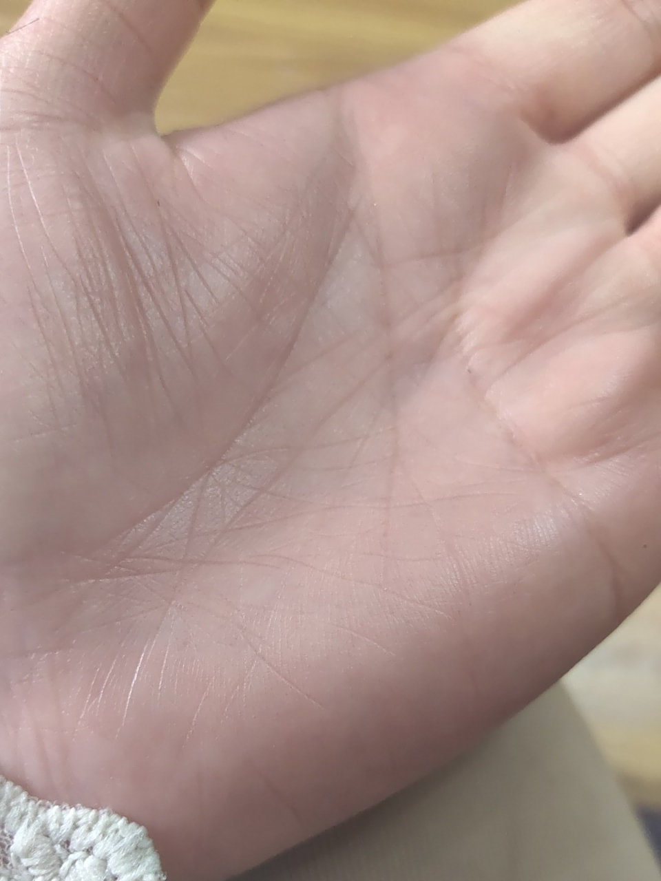 生命线有三角纹是不是代表生病了各位大神