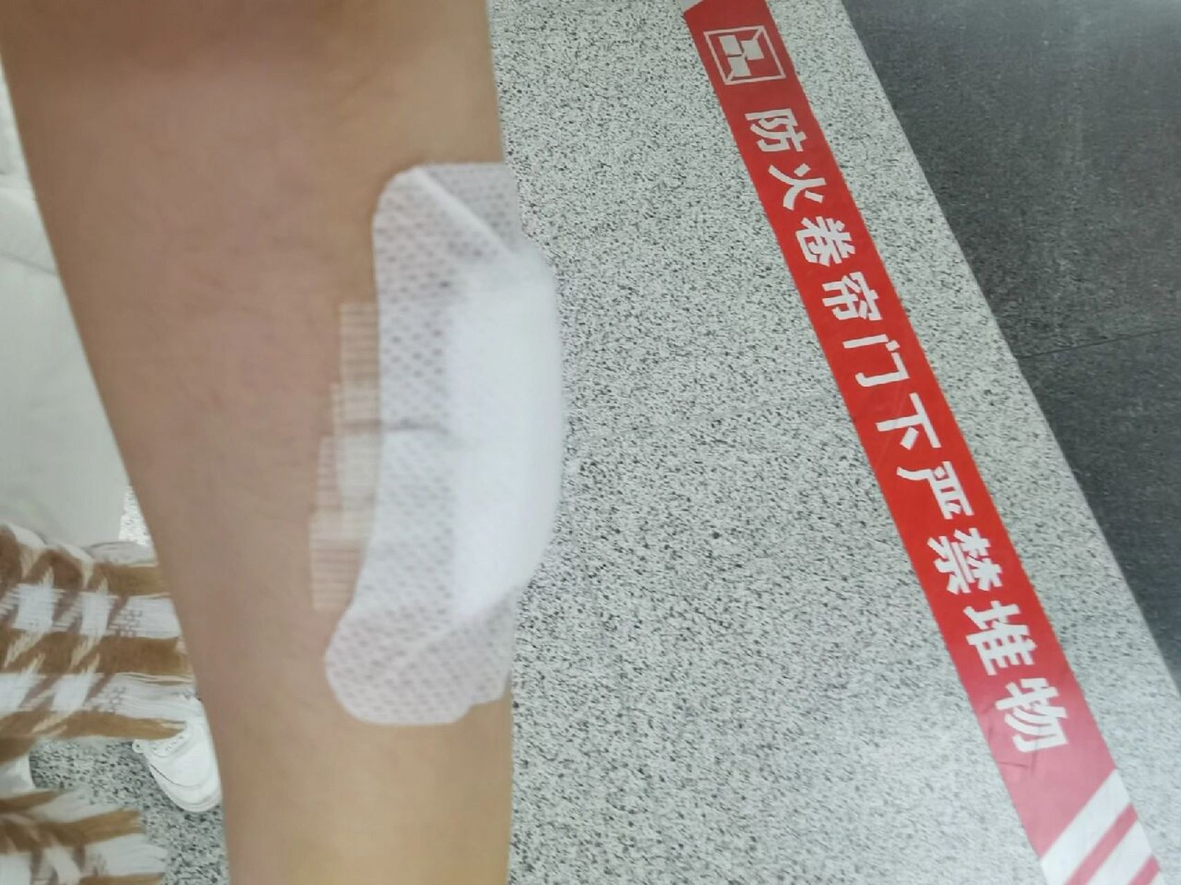 昨天去医院挂了皮肤科看了,医生说是纤维瘤有两种治疗方式,一是开刀