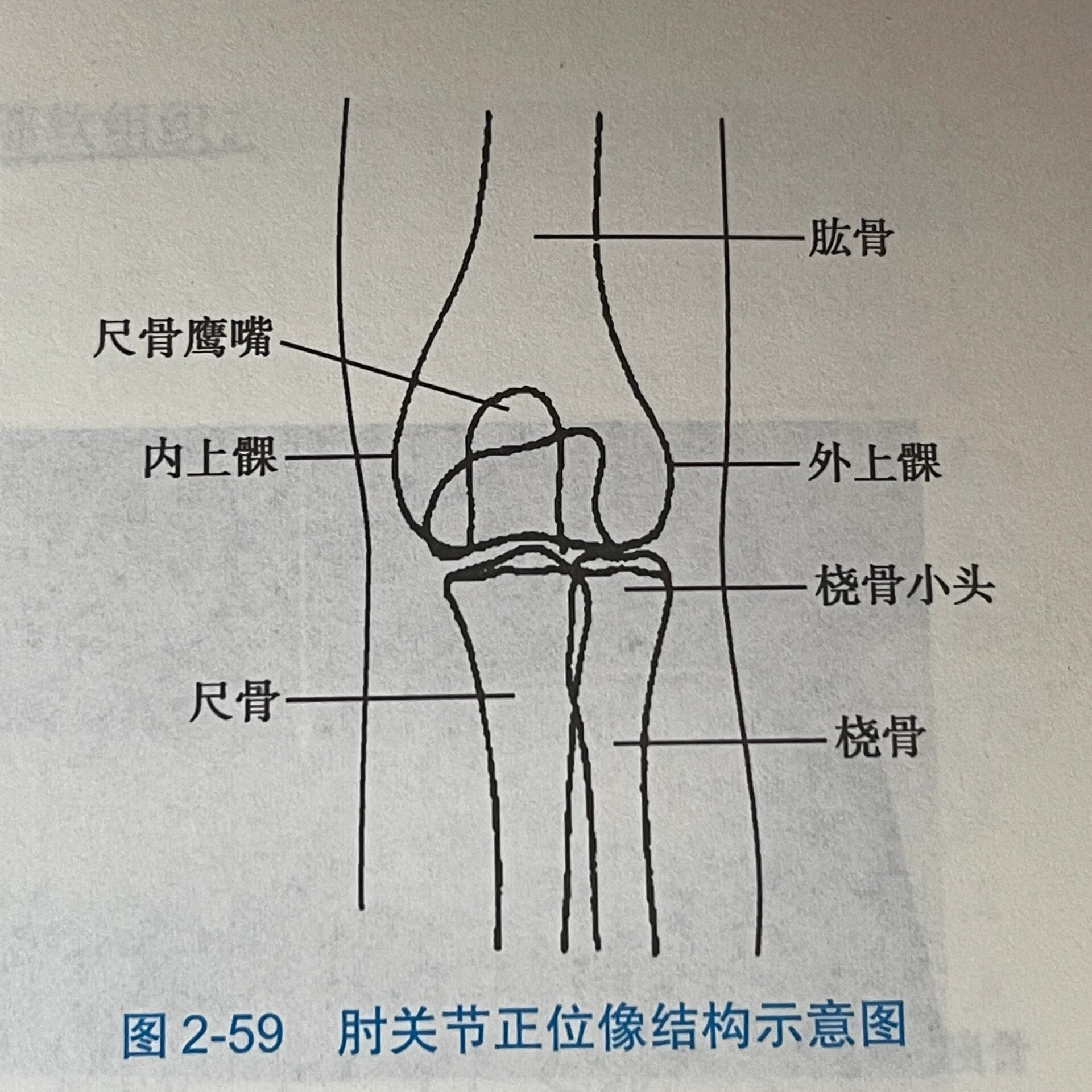 正常肘关节x线图片图片