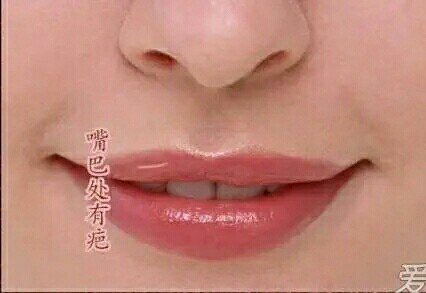 影响感情婚姻的疤痕面相 166额头有疤痕,早年感情不稳.