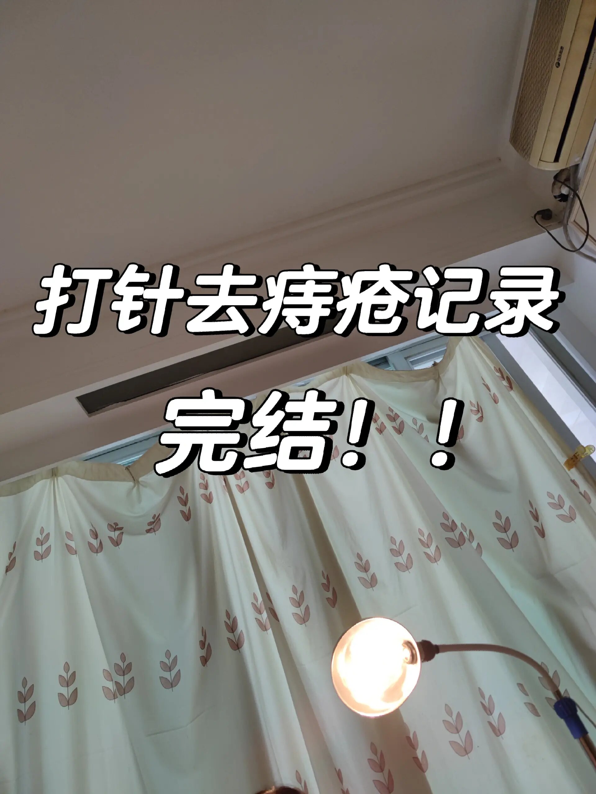给大家报告一下打针去痔疮的后续结果