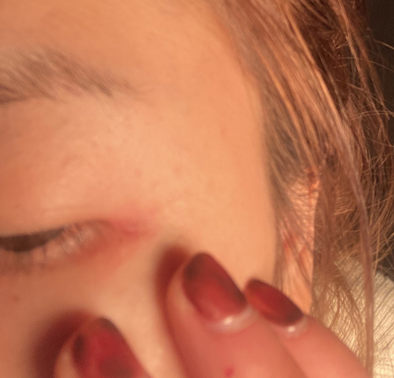 我也不知道有没有小姐妹眼尾一段时间发红 痒 干燥