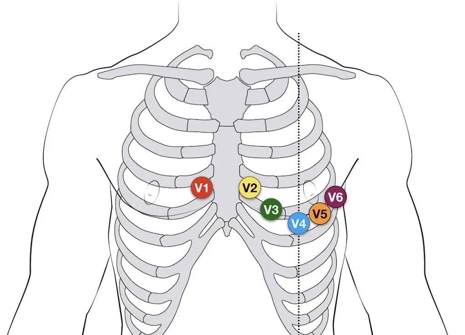十八导心电图颜色位置图片