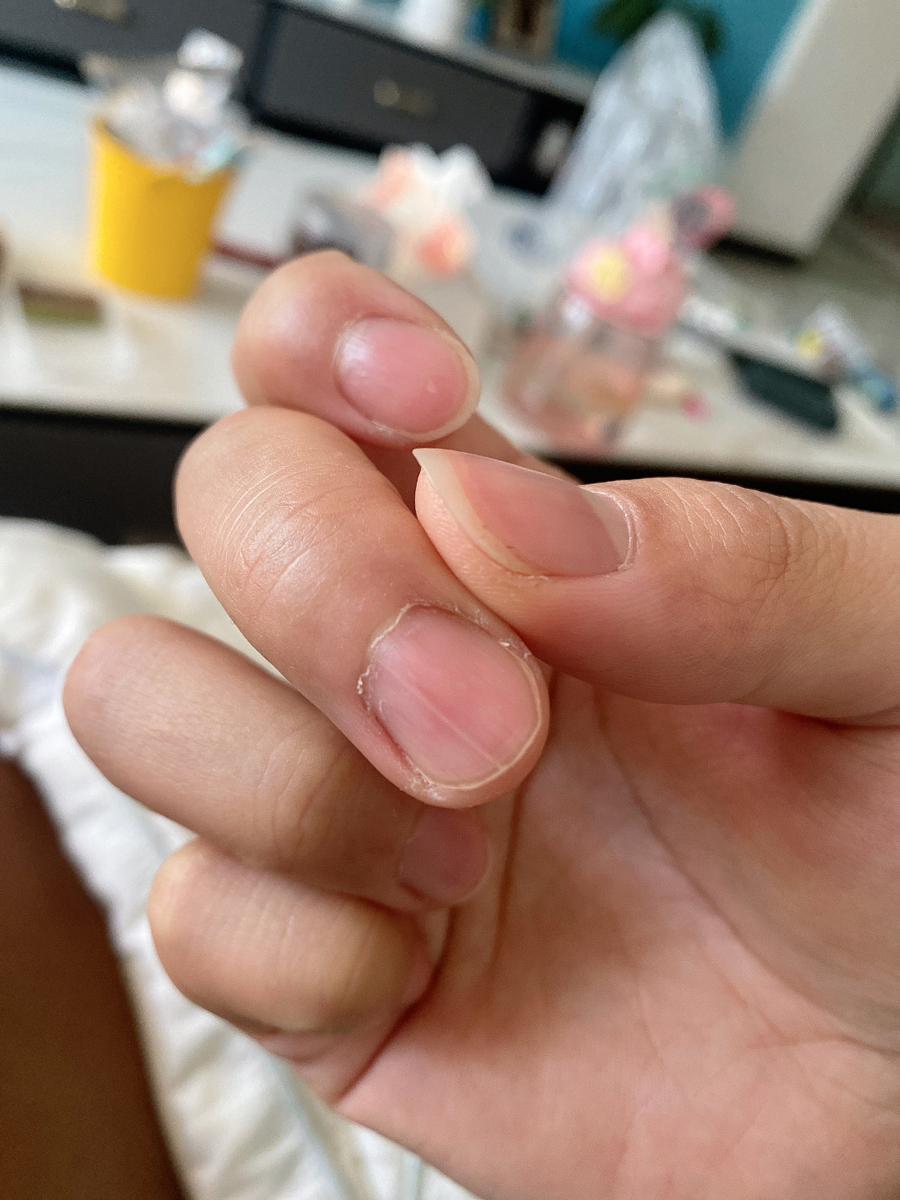 已经两年多了,指甲中间一条裂缝,长出来后就会从中间裂开,只有右手